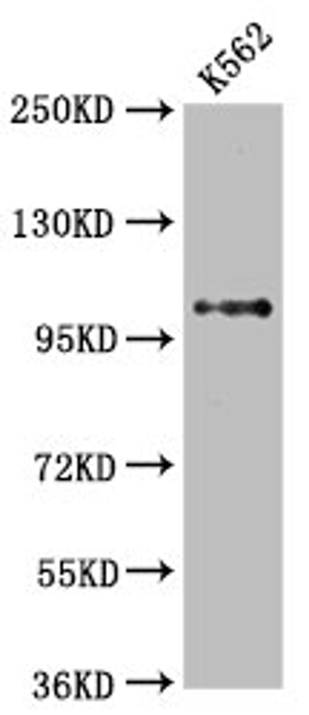 Western Blot. Positive WB detected in: K562 whole cell lysate. All lanes: DGCR8 antibody at 2.65μg/ml. Secondary. Goat polyclonal to rabbit IgG at 1/50000 dilution. Predicted band size: 87, 33, 83 KDa. Observed band size: 100 KDa. 