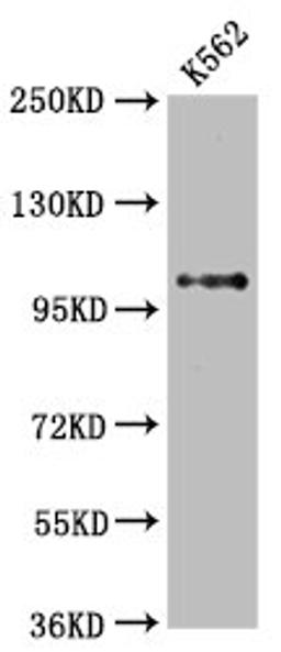 Western Blot. Positive WB detected in: K562 whole cell lysate. All lanes: DGCR8 antibody at 2.65μg/ml. Secondary. Goat polyclonal to rabbit IgG at 1/50000 dilution. Predicted band size: 87, 33, 83 KDa. Observed band size: 100 KDa. 