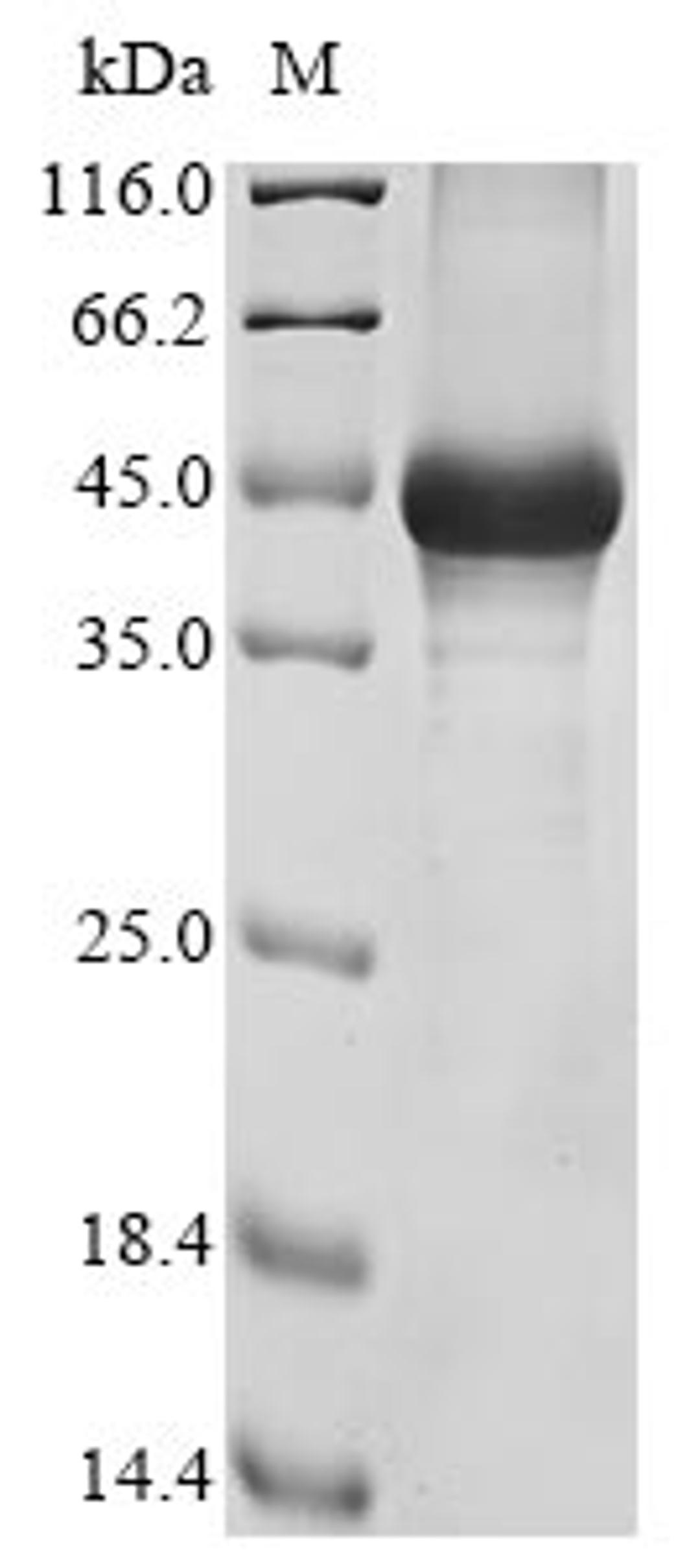 (Tris-Glycine gel) Discontinuous SDS-PAGE (reduced) with 5% enrichment gel and 15% separation gel.