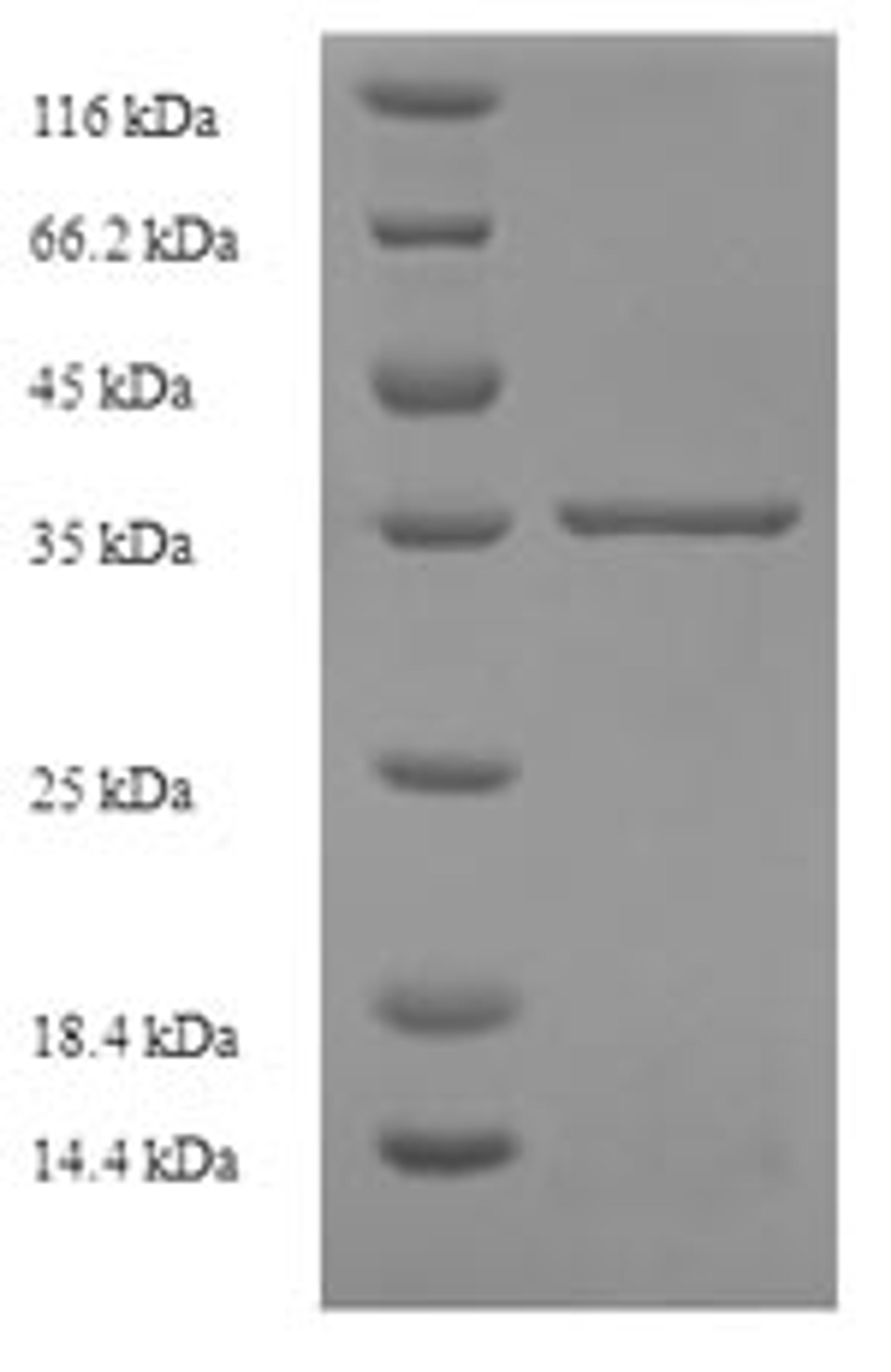 (Tris-Glycine gel) Discontinuous SDS-PAGE (reduced) with 5% enrichment gel and 15% separation gel.