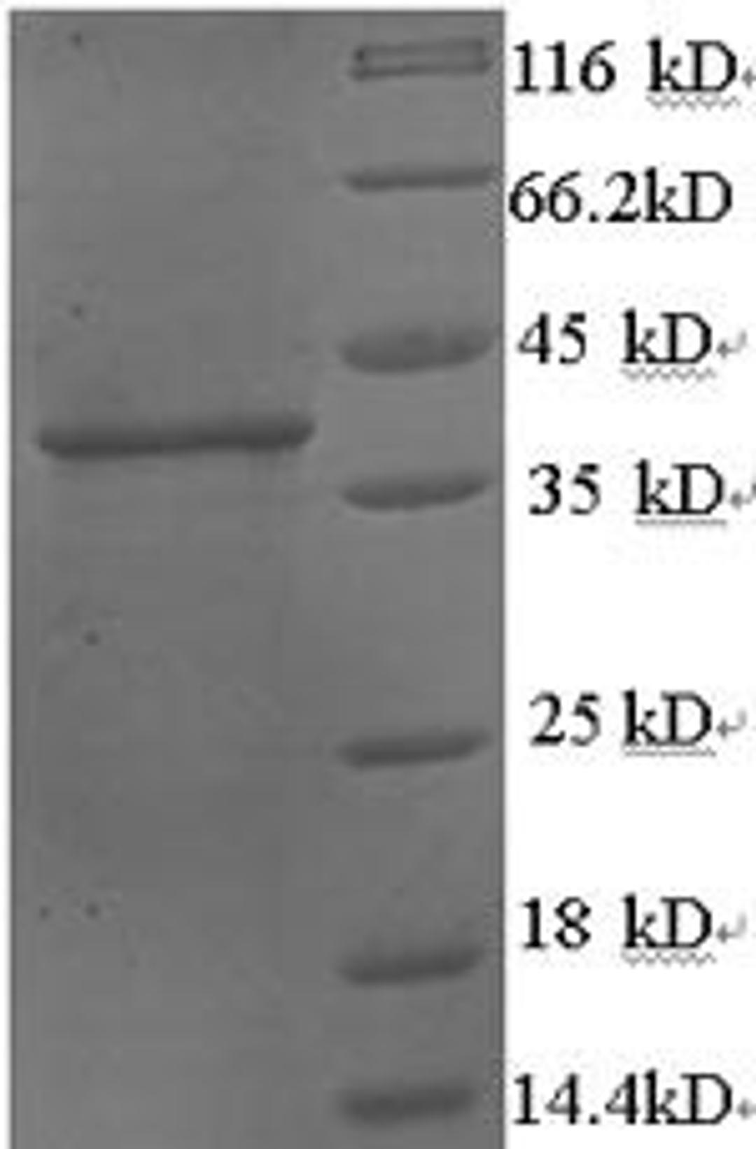 (Tris-Glycine gel) Discontinuous SDS-PAGE (reduced) with 5% enrichment gel and 15% separation gel.