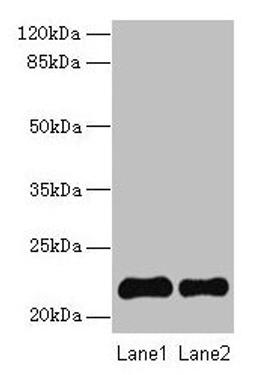 Western blot. All lanes: SIRPD antibody at 14µg/ml. Lane 1: 293T whole cell lysate. Lane 2: Mouse spleen tissue. Secondary. Goat polyclonal to rabbit IgG at 1/10000 dilution. Predicted band size: 22 kDa. Observed band size: 22 kDa