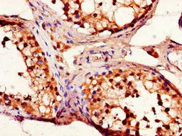 Immunohistochemistry of paraffin-embedded human testis tissue using CSB-PA007450LA01HU at dilution of 1:100