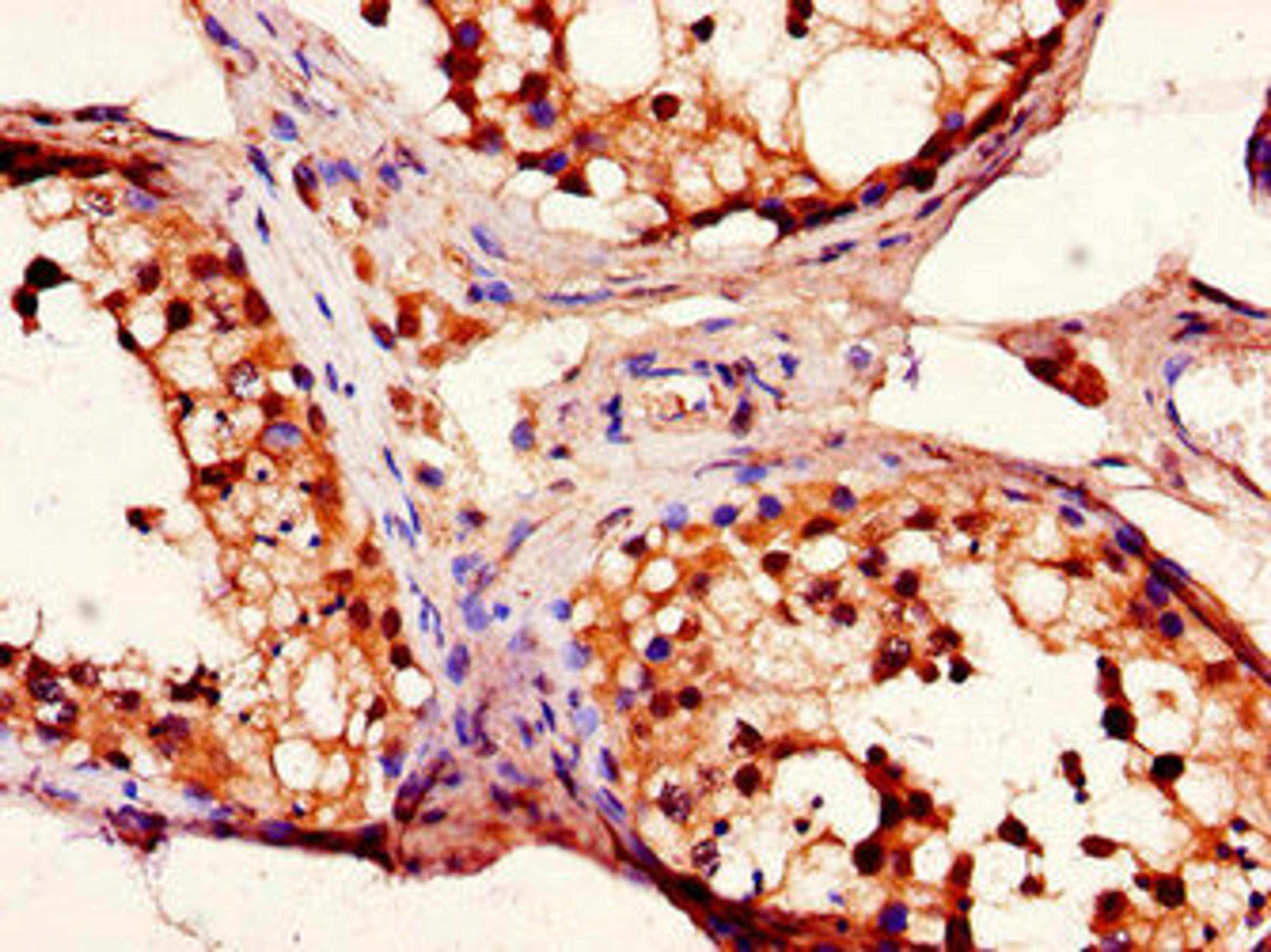 Immunohistochemistry of paraffin-embedded human testis tissue using CSB-PA007450LA01HU at dilution of 1:100