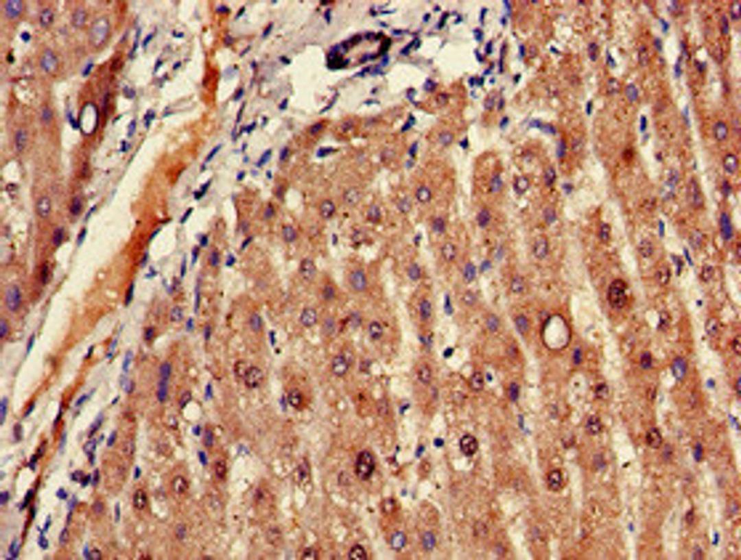 Immunohistochemistry of paraffin-embedded human liver tissue using CSB-PA007959LA01HU at dilution of 1:100