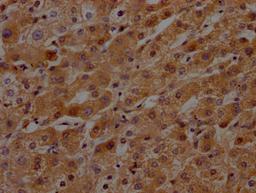 IHC image of CSB-RA553053A0HU diluted at 1:100 and staining in paraffin-embedded human liver tissue performed on a Leica BondTM system. After dewaxing and hydration, antigen retrieval was mediated by high pressure in a citrate buffer (pH 6.0). Section was blocked with 10% normal goat serum 30min at RT. Then primary antibody (1% BSA) was incubated at 4℃ overnight. The primary is detected by a Goat anti-rabbit IgG polymer labeled by HRP and visualized using 0.05% DAB.