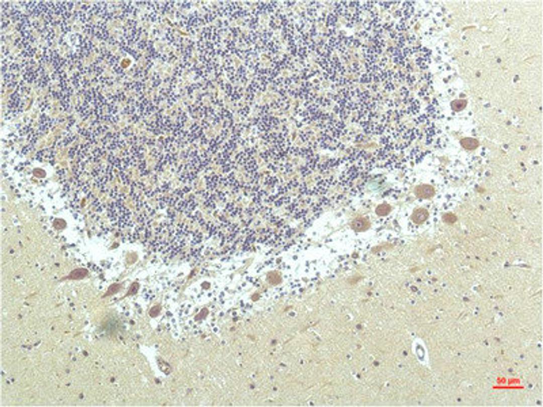 Immunohistochemical analysis of paraffin-embedded Human Brain Tissue using PPAR Delta Mouse mAb diluted at 1:200.
