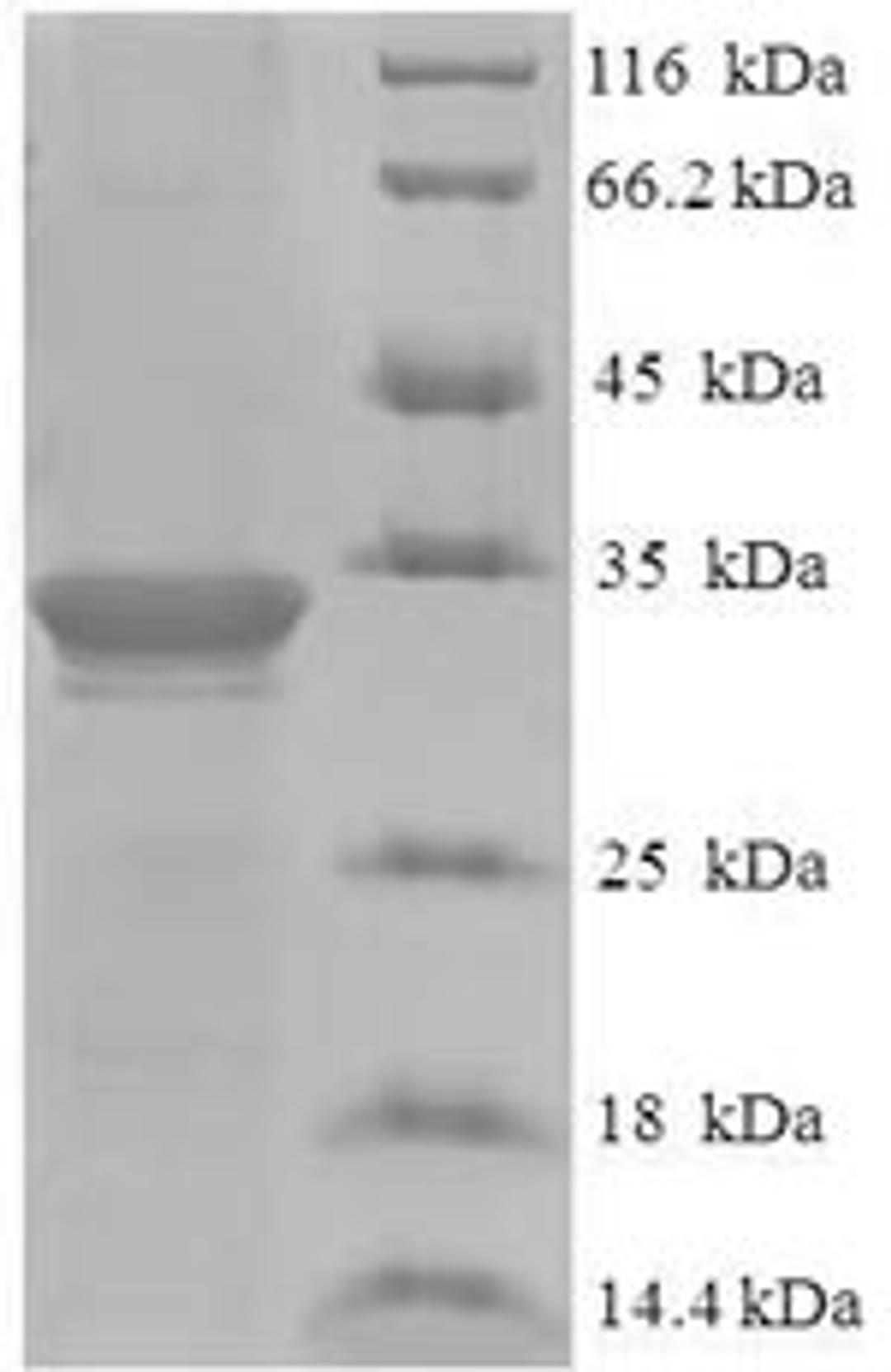 (Tris-Glycine gel) Discontinuous SDS-PAGE (reduced) with 5% enrichment gel and 15% separation gel.