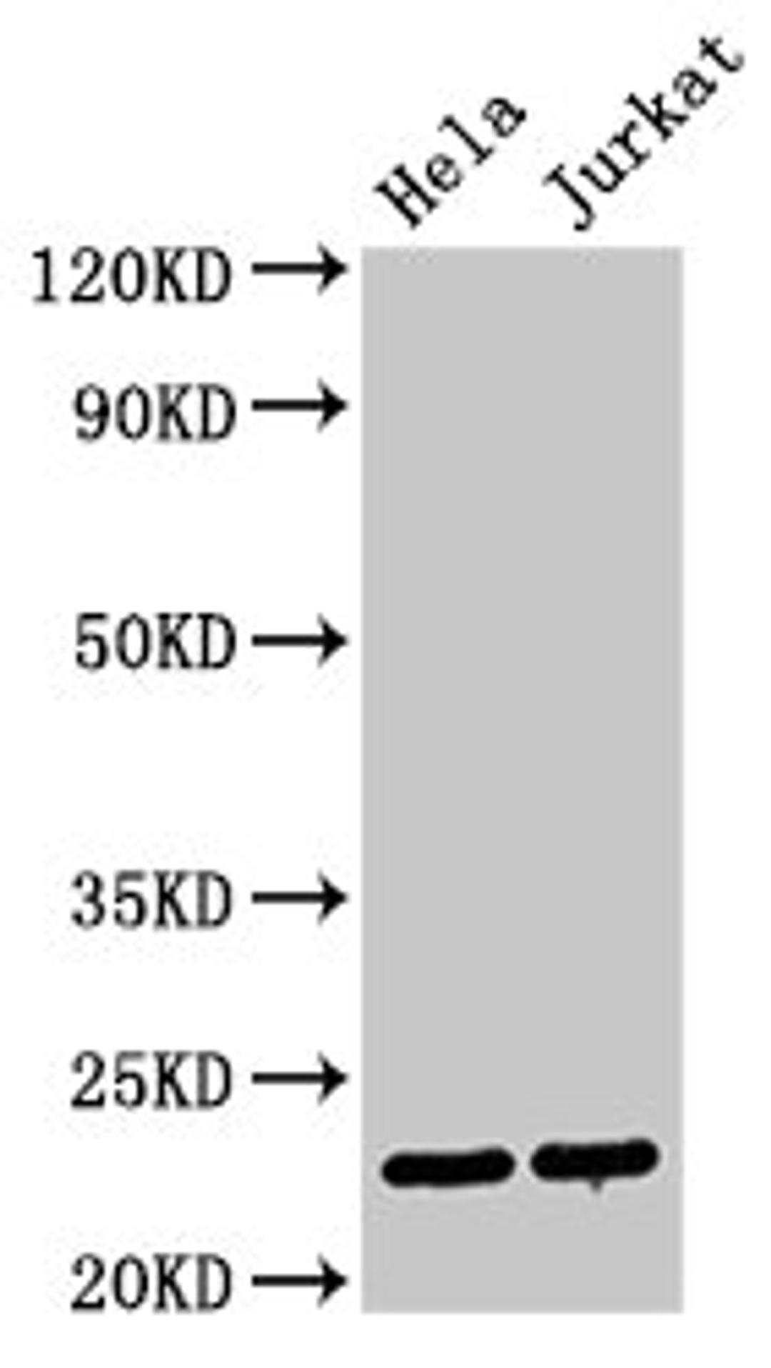 Western Blot. Positive WB detected in: Hela whole cell lysate, Jurkat whole cell lysate. All lanes: PTTG1 antibody at 3µg/ml. Secondary. Goat polyclonal to rabbit IgG at 1/50000 dilution. Predicted band size: 23 kDa. Observed band size: 23 kDa