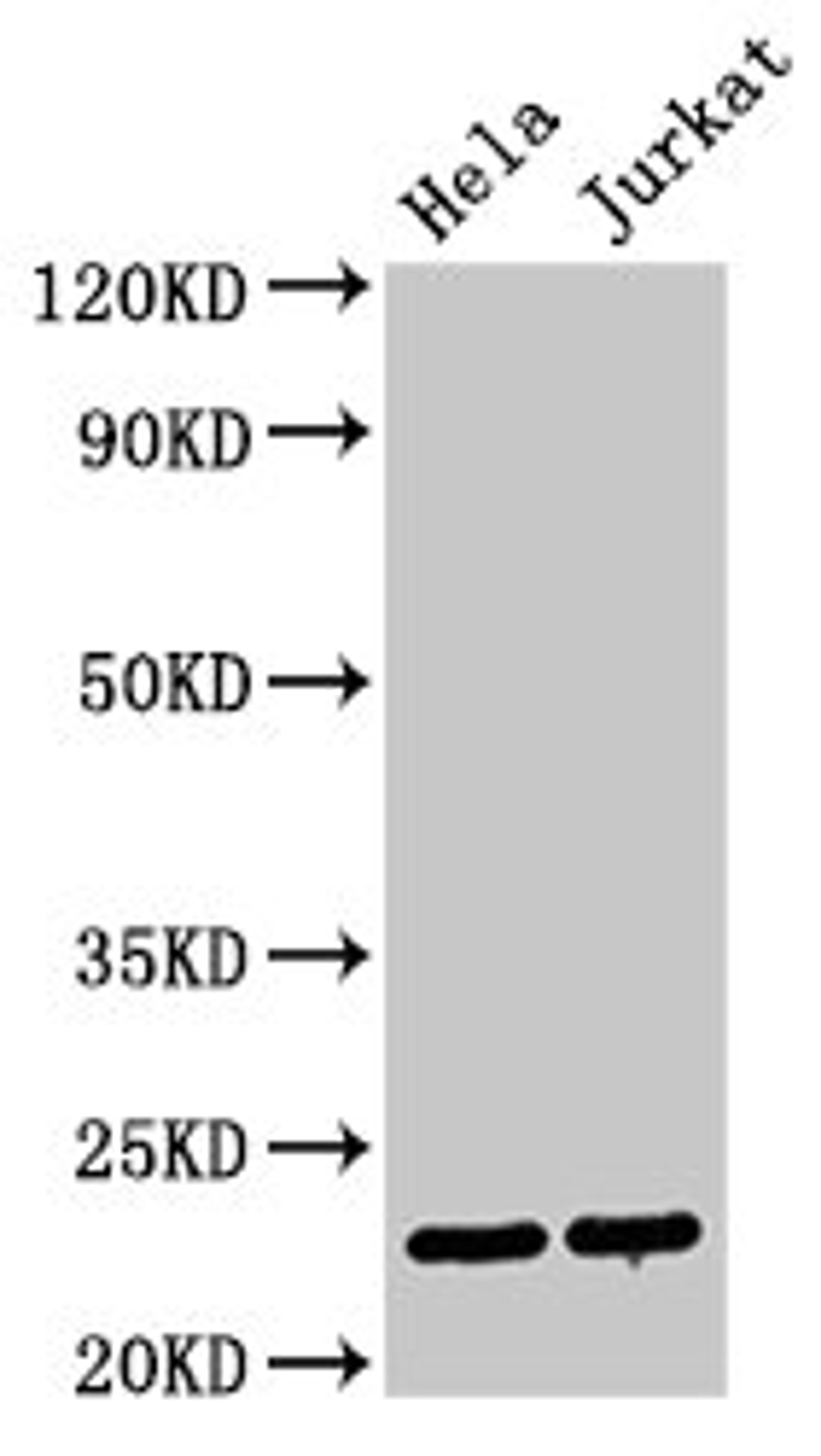Western Blot. Positive WB detected in: Hela whole cell lysate, Jurkat whole cell lysate. All lanes: PTTG1 antibody at 3µg/ml. Secondary. Goat polyclonal to rabbit IgG at 1/50000 dilution. Predicted band size: 23 kDa. Observed band size: 23 kDa