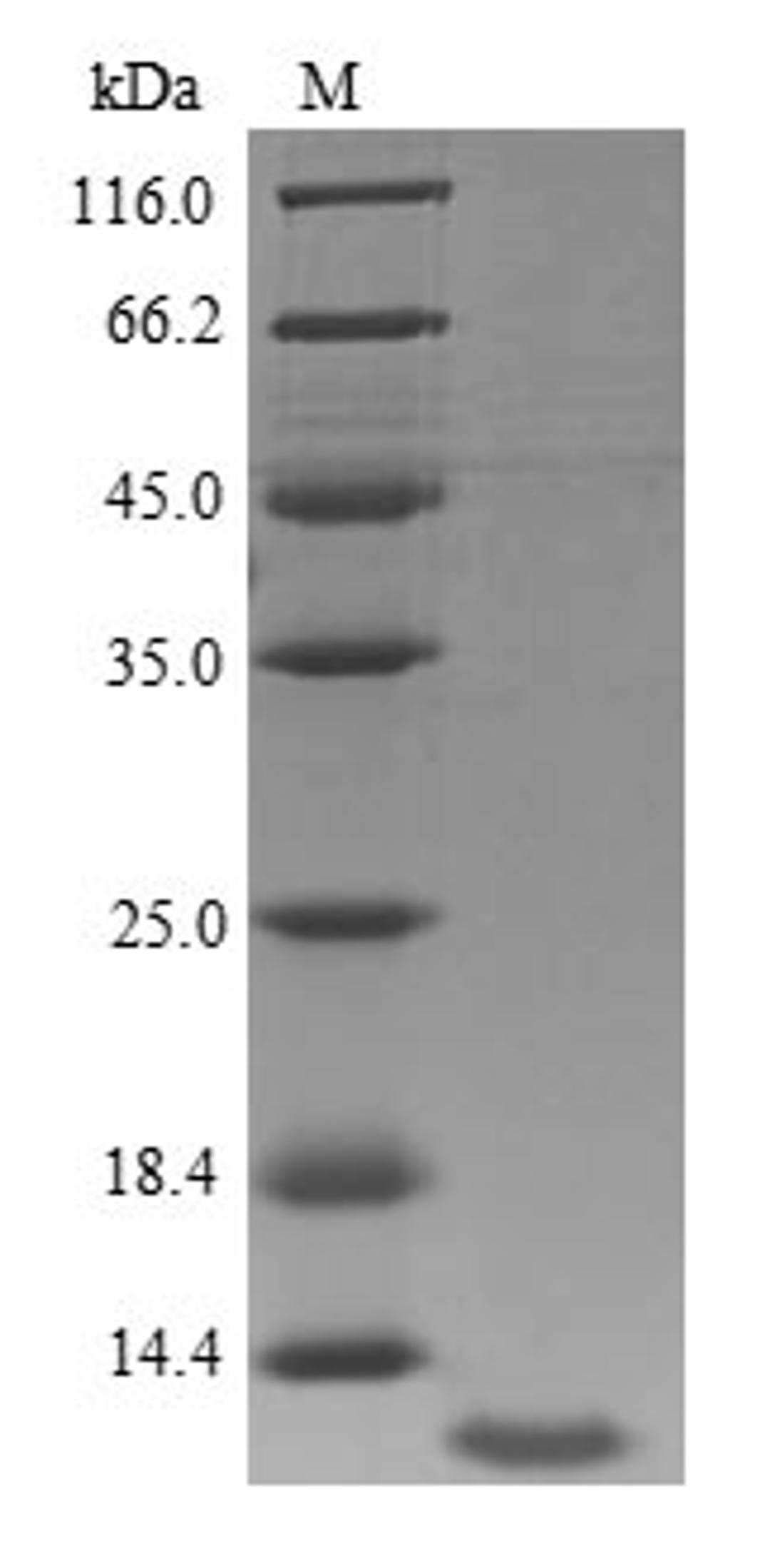 (Tris-Glycine gel) Discontinuous SDS-PAGE (reduced) with 5% enrichment gel and 15% separation gel.