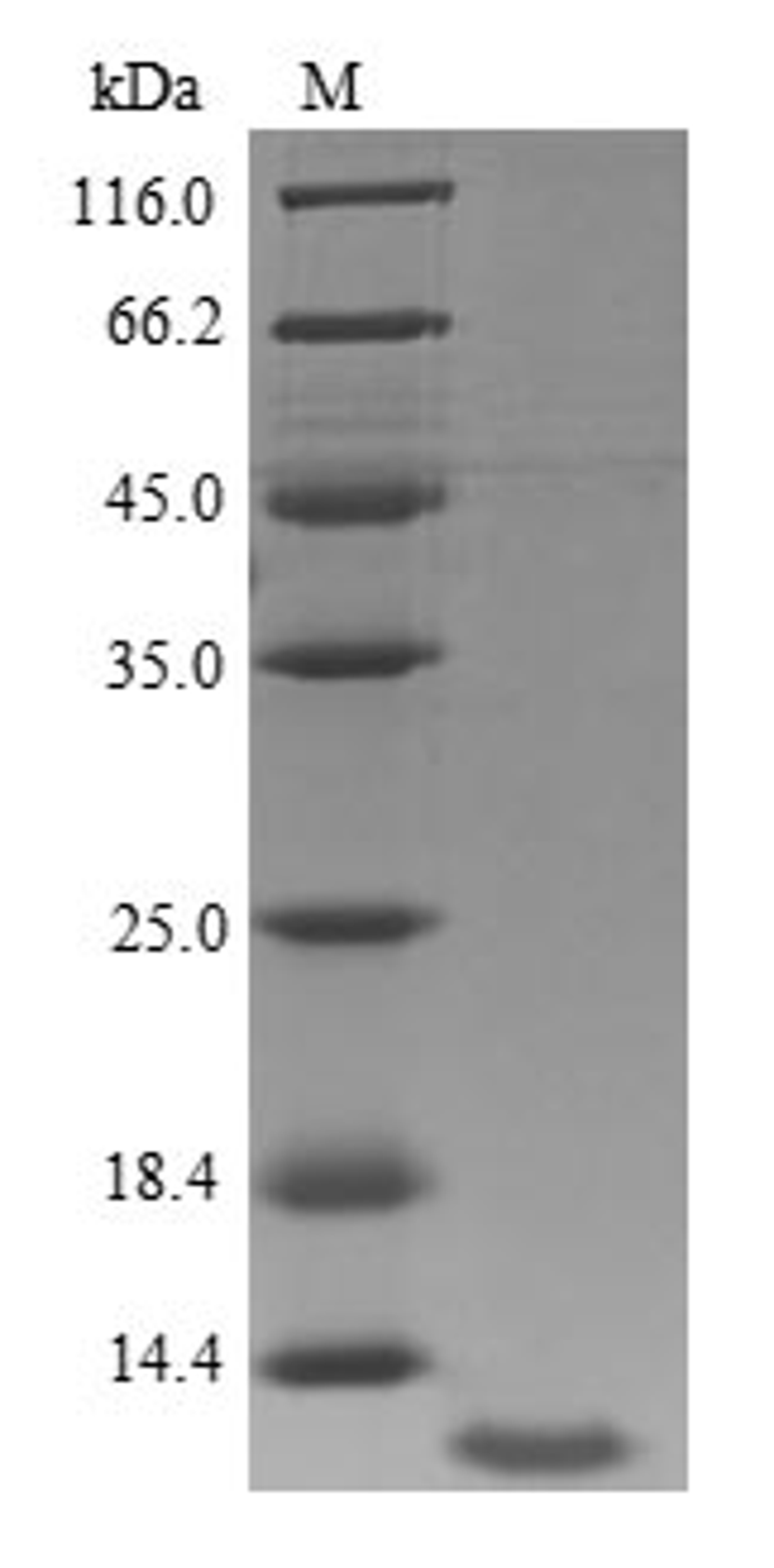(Tris-Glycine gel) Discontinuous SDS-PAGE (reduced) with 5% enrichment gel and 15% separation gel.