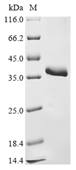 (Tris-Glycine gel) Discontinuous SDS-PAGE (reduced) with 5% enrichment gel and 15% separation gel.