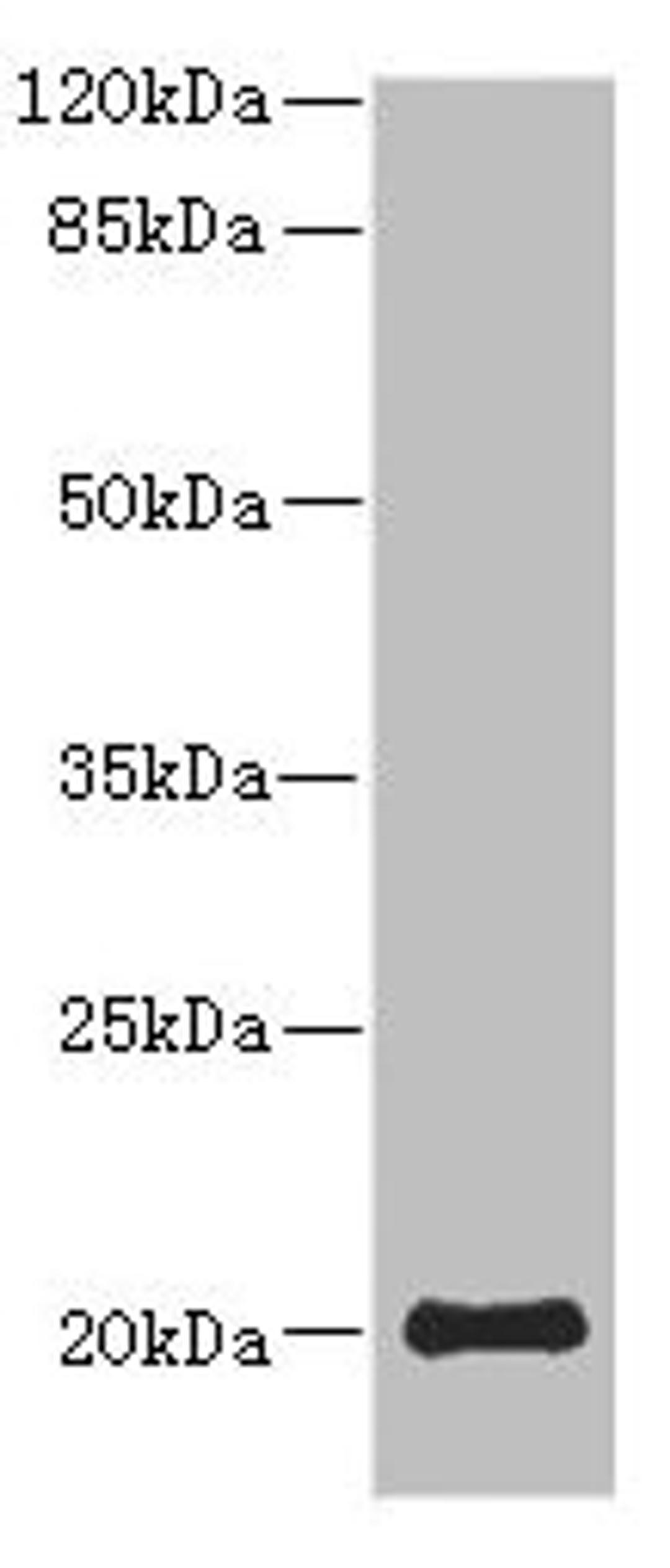Western blot. All lanes: PPP3R2 antibody at 9.25ug/ml + Mouse brain tissue. Secondary. Goat polyclonal to rabbit IgG at 1/10000 dilution. Predicted band size: 20 kDa. Observed band size: 20 kDa. 