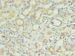 Immunohistochemistry of paraffin-embedded human kidney tissue using CSB-PA019862LA01HU at dilution of 1:100
