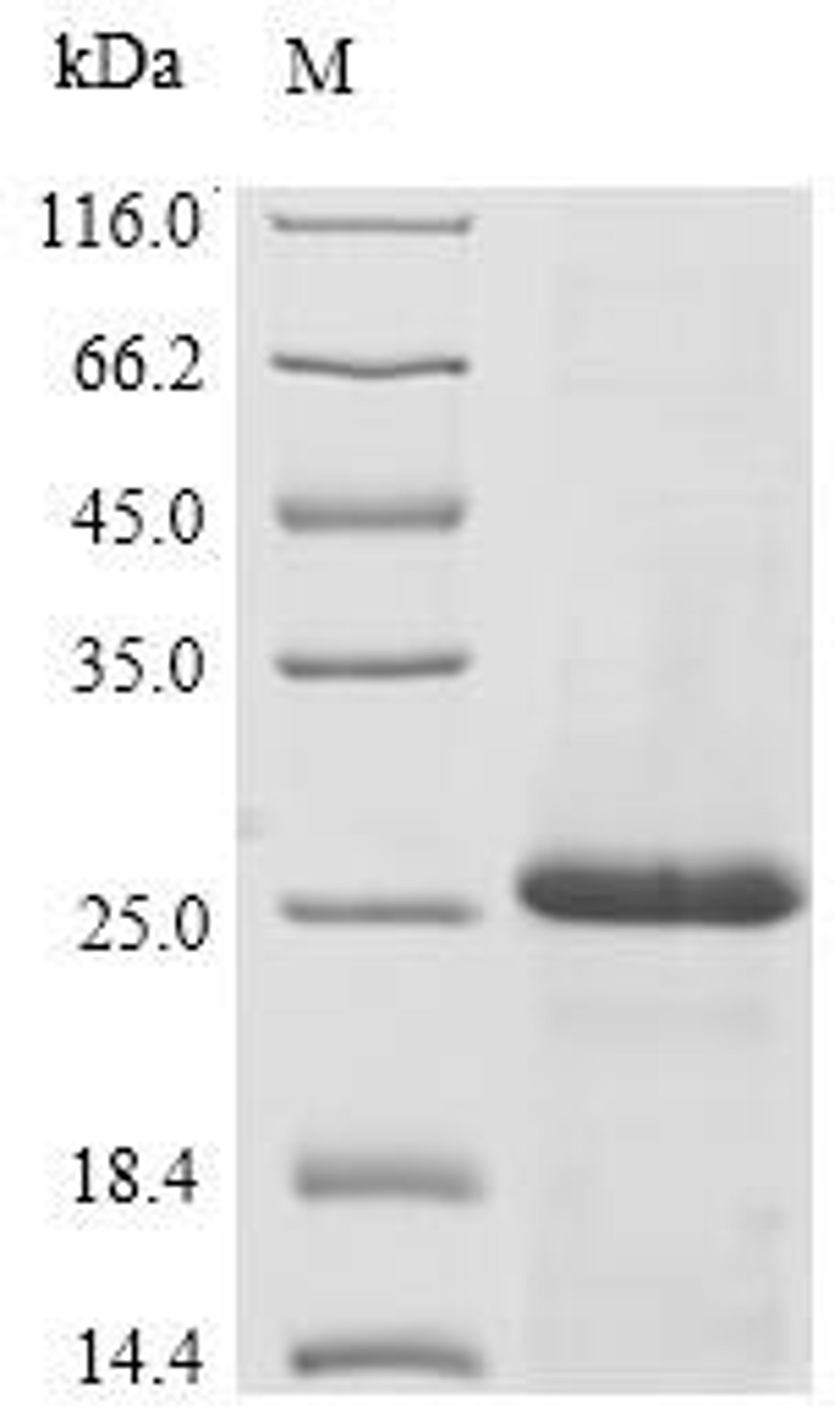 (Tris-Glycine gel) Discontinuous SDS-PAGE (reduced) with 5% enrichment gel and 15% separation gel.