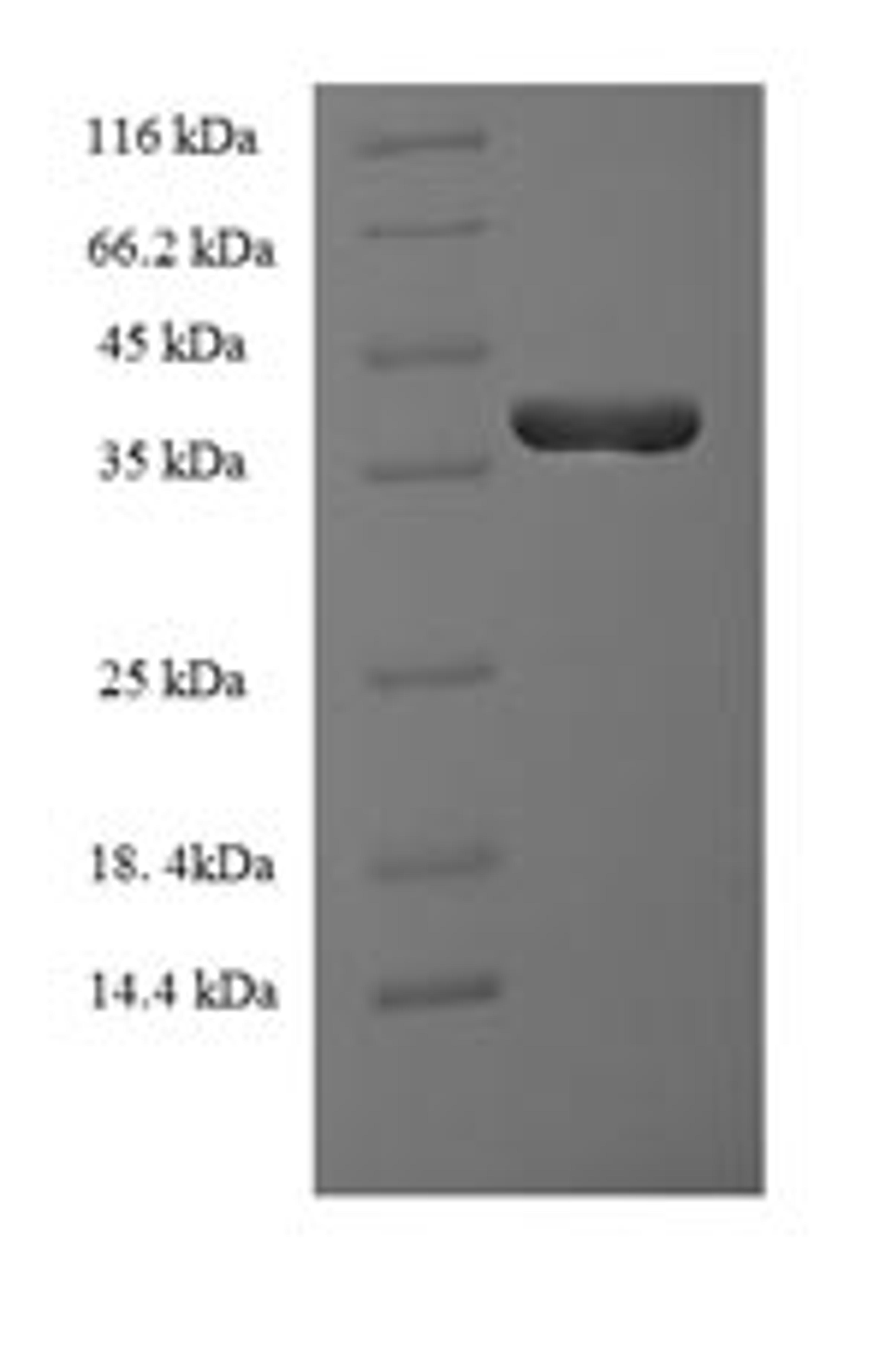 (Tris-Glycine gel) Discontinuous SDS-PAGE (reduced) with 5% enrichment gel and 15% separation gel.
