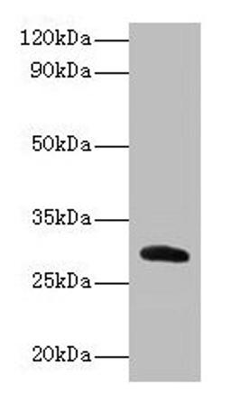 Western blot. All lanes: Cela2a antibody at 2µg/ml + Recombinant Chymotrypsin-like elastase family member 2A protein 0.1µg. Secondary. Goat polyclonal to rabbit lgG at 1/15000 dilution. Predicted band size: 29 kDa. Observed band size: 29 kDa
