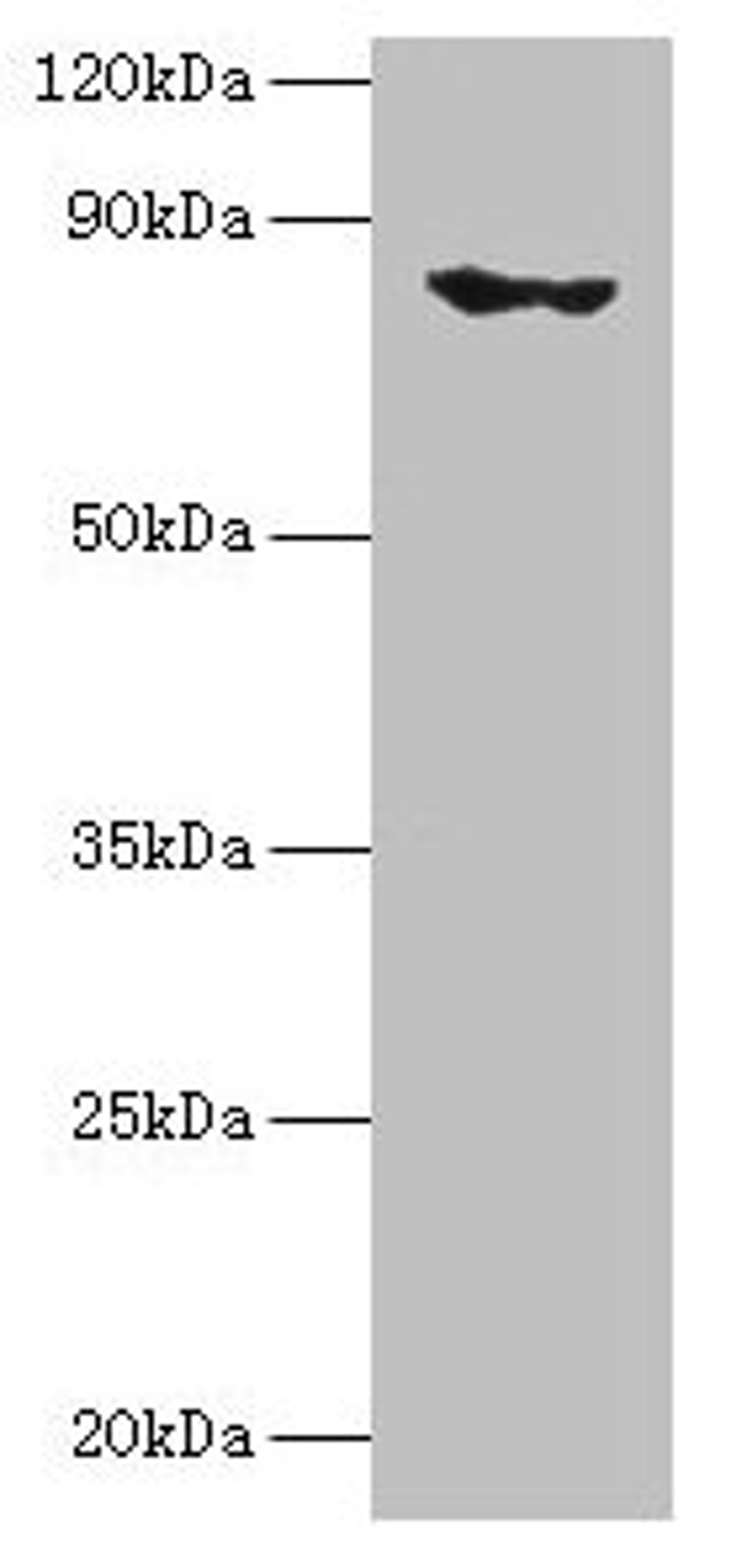 Western blot. All lanes: EHHADH antibody at 2µg/ml + Mouse kidney tissue. Secondary. Goat polyclonal to rabbit IgG at 1/10000 dilution. Predicted band size: 80, 70 kDa. Observed band size: 80 kDa