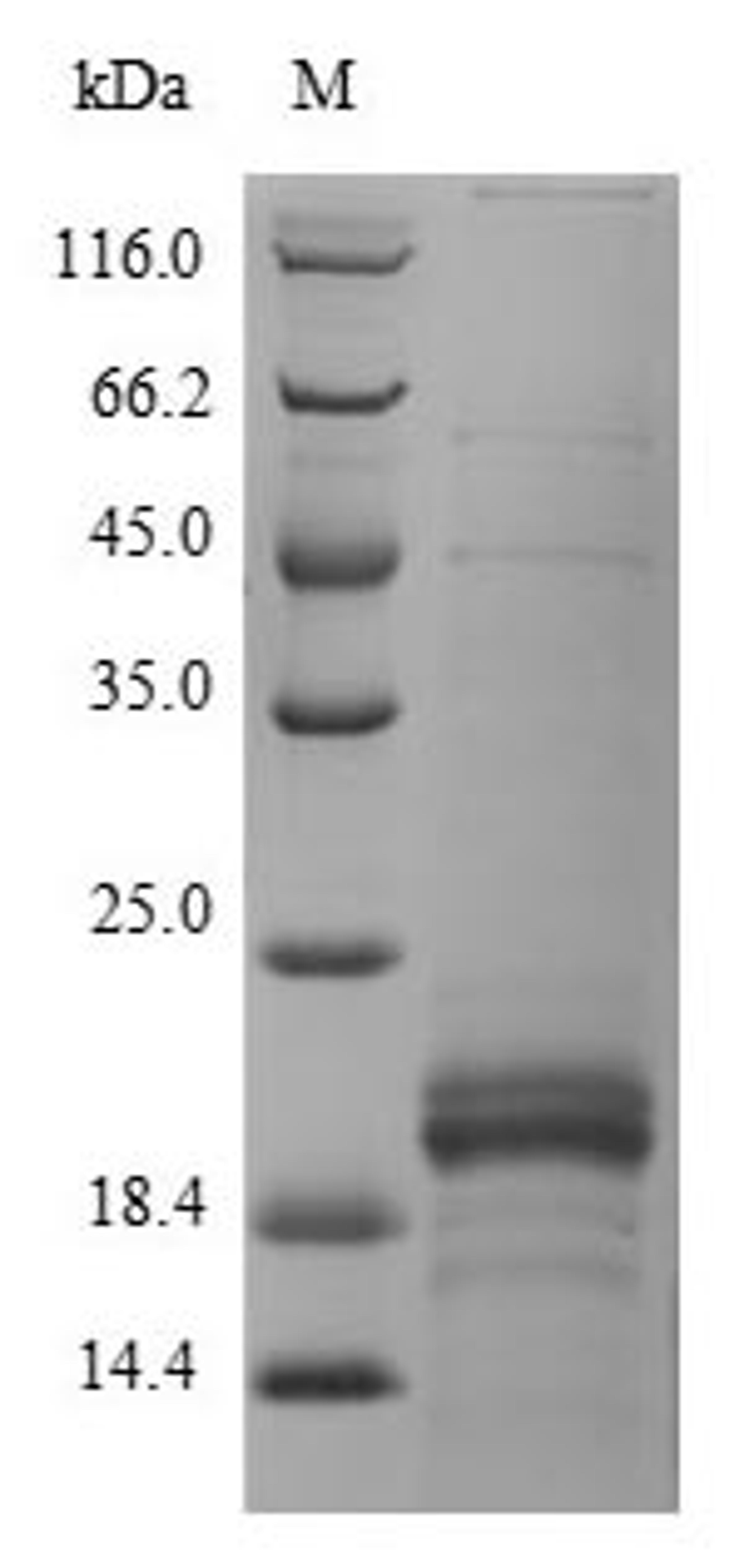 (Tris-Glycine gel) Discontinuous SDS-PAGE (reduced) with 5% enrichment gel and 15% separation gel.