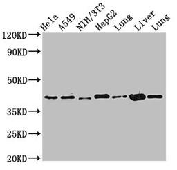 Western Blot. Positive WB detected in: Hela whole cell lysate, A549 whole cell lysate, NIH/3T3 whole cell lysate, HepG2 whole cell lysate, Rat lung tissue, Mouse liver tissue, Mouse lung tissue. All lanes: ACAA2 antibody at 2.4µg/ml. Secondary. Goat polyclonal to rabbit IgG at 1/50000 dilution. Predicted band size: 42 kDa. Observed band size: 42 kDa