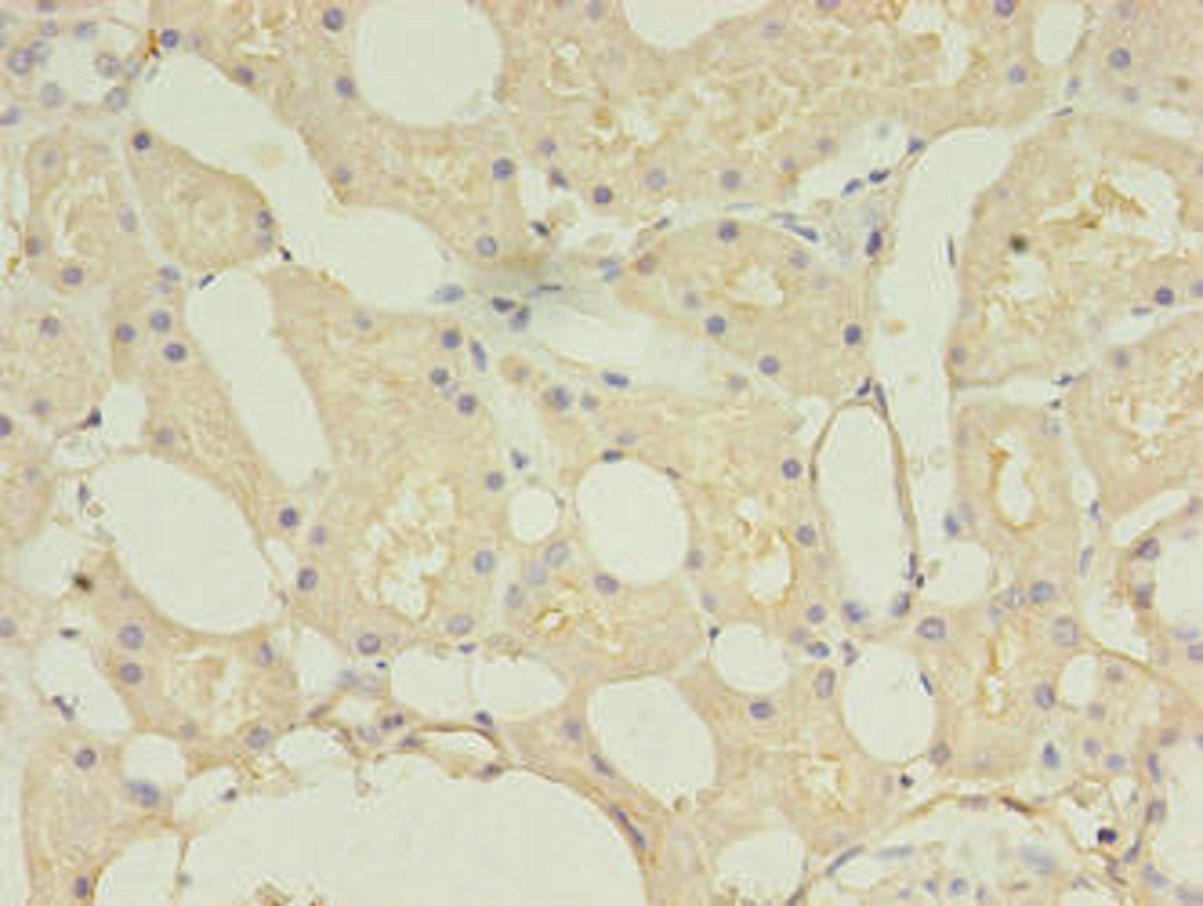 Immunohistochemistry of paraffin-embedded human kidney tissue using CSB-PA881018EA01HU at dilution of 1:100