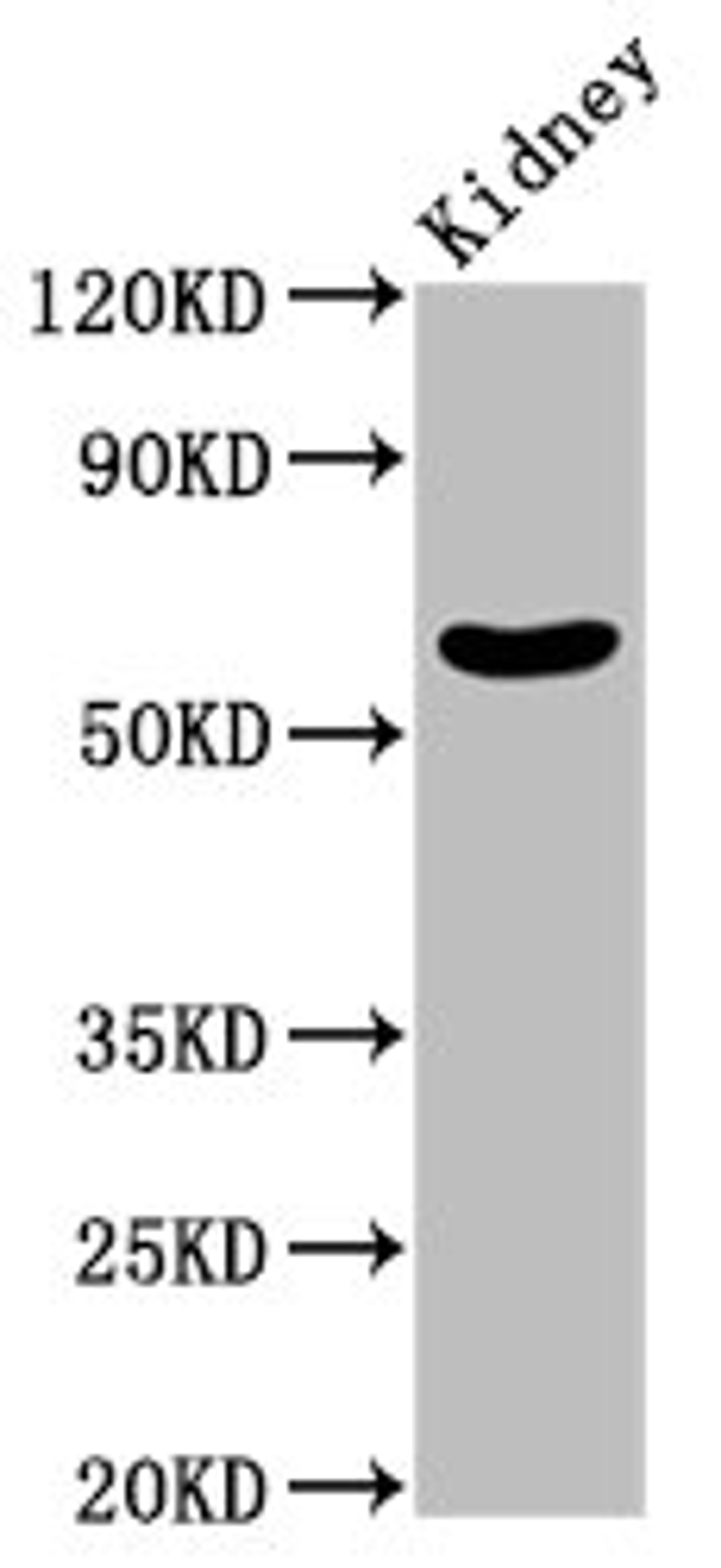 Western Blot. Positive WB detected in: Mouse kidney tissue. All lanes: MGAT3 antibody at 2.35ug/ml. Secondary. Goat polyclonal to rabbit IgG at 1/50000 dilution. Predicted band size: 62 kDa. Observed band size: 62 kDa. 