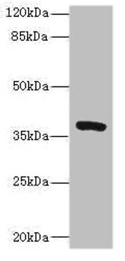 Western blot. All lanes: TMEM64 antibody at 8µg/ml + Mouse brain tissue. Secondary. Goat polyclonal to rabbit IgG at 1/10000 dilution. Predicted band size: 40, 13, 15, 34 kDa. Observed band size: 40 kDa