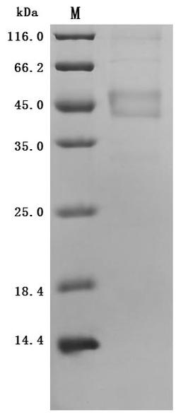 (Tris-Glycine gel) Discontinuous SDS-PAGE (reduced) with 5% enrichment gel and 15% separation gel.