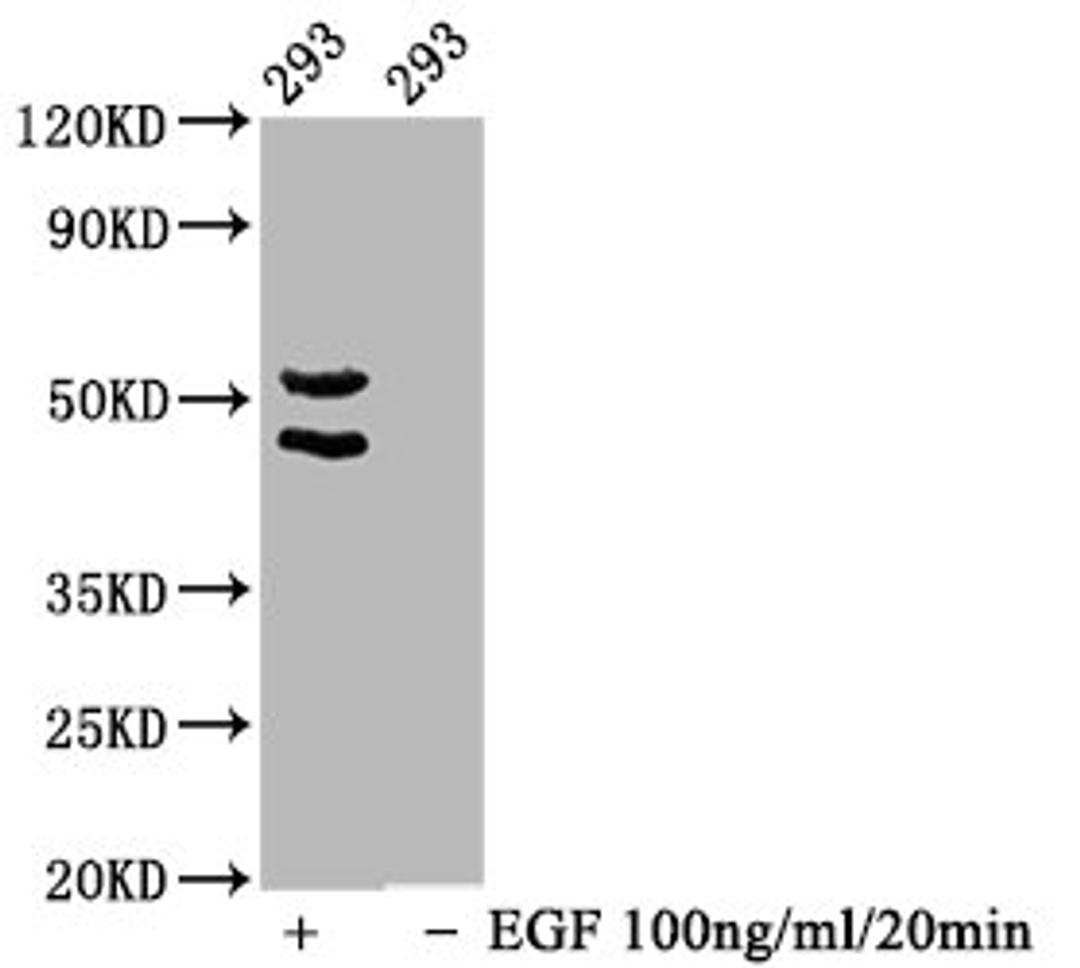 Western Blot. Positive WB detected in 293 whole cell lysate(treated with EGF or not). All lanes Phospho-MAPK8/MAPK9/MAPK10 antibody at 1.65μg/ml. Secondary. Goat polyclonal to rabbit IgG at 1/50000 dilution. Predicted band size: 46,54 KDa. Observed band size: 46,54 KDa. 
