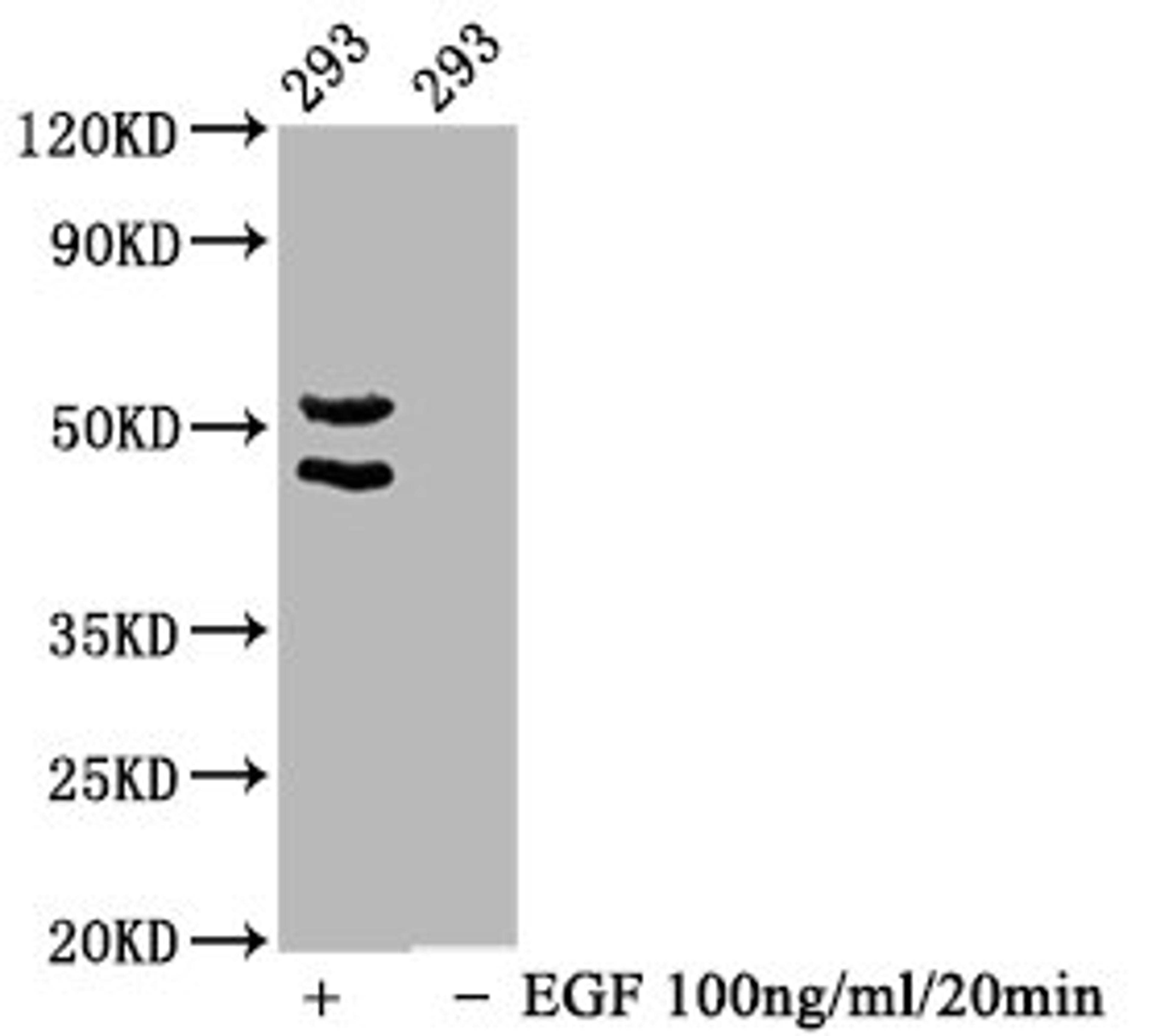 Western Blot. Positive WB detected in 293 whole cell lysate(treated with EGF or not). All lanes Phospho-MAPK8/MAPK9/MAPK10 antibody at 1.65μg/ml. Secondary. Goat polyclonal to rabbit IgG at 1/50000 dilution. Predicted band size: 46,54 KDa. Observed band size: 46,54 KDa. 
