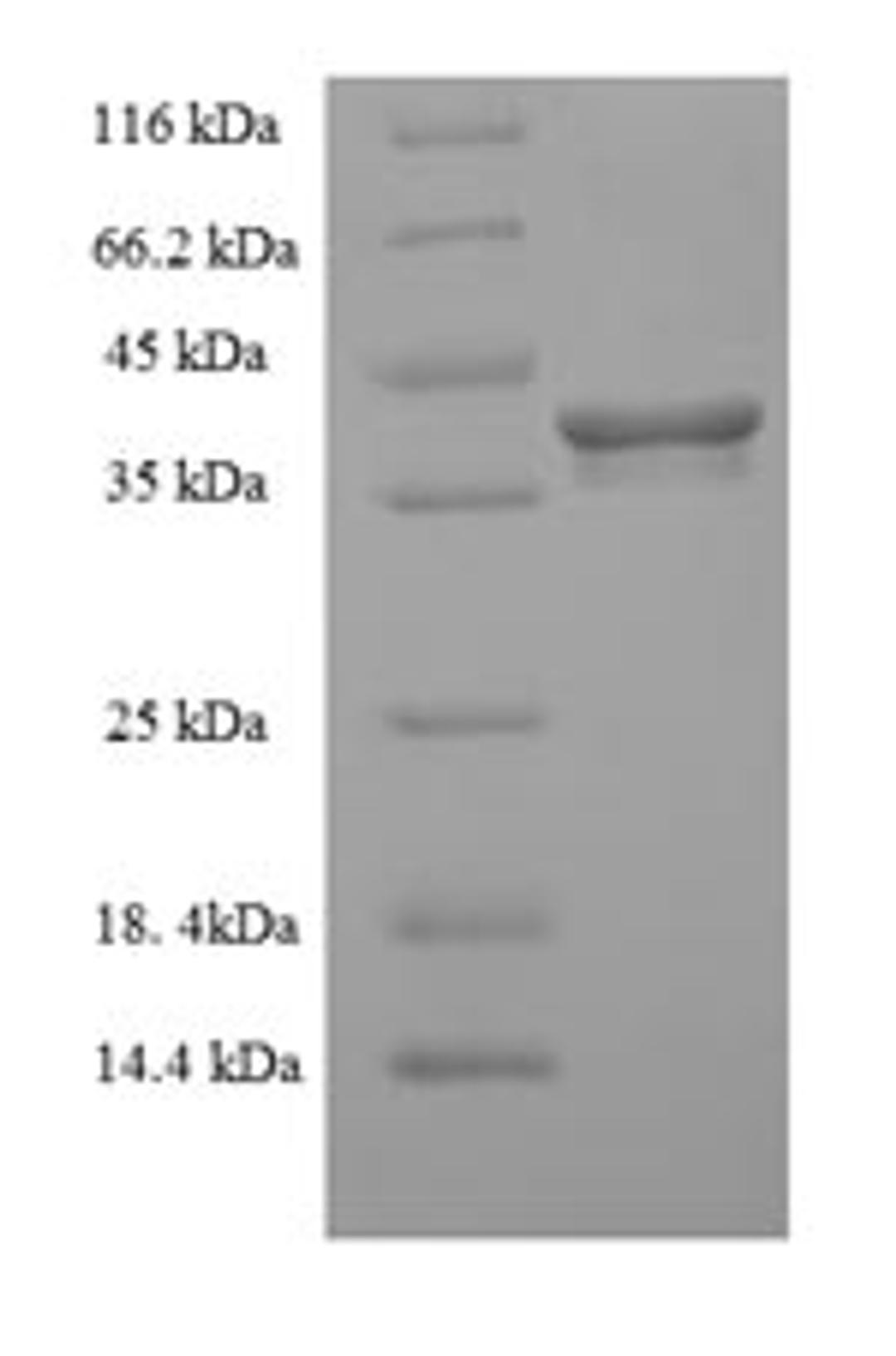 (Tris-Glycine gel) Discontinuous SDS-PAGE (reduced) with 5% enrichment gel and 15% separation gel.