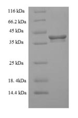 (Tris-Glycine gel) Discontinuous SDS-PAGE (reduced) with 5% enrichment gel and 15% separation gel.