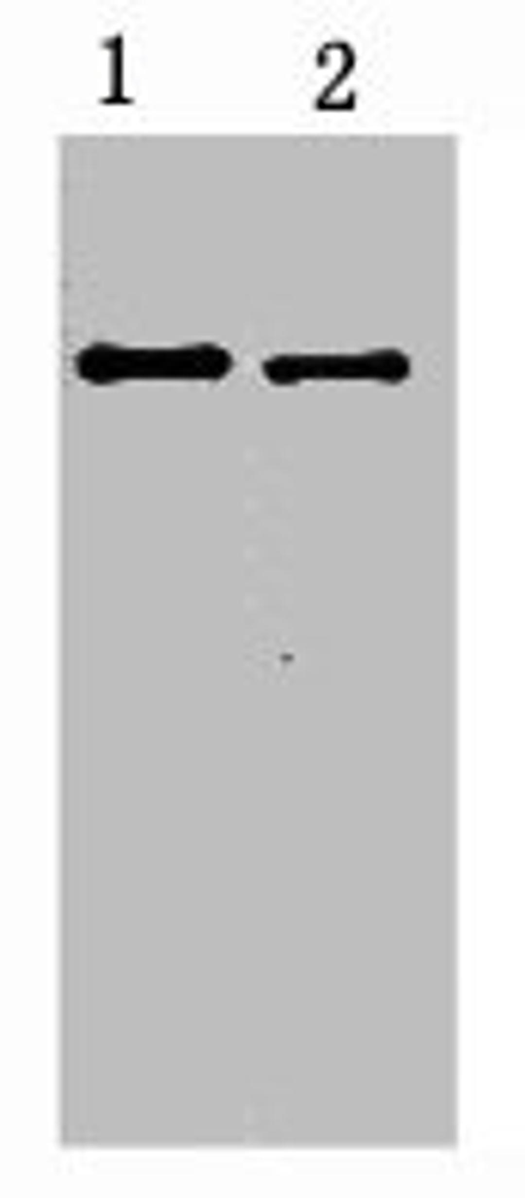 2ug S-Tag fusion protein+ Primary antibody dilution at  1) 1:5000 2) 1:10000