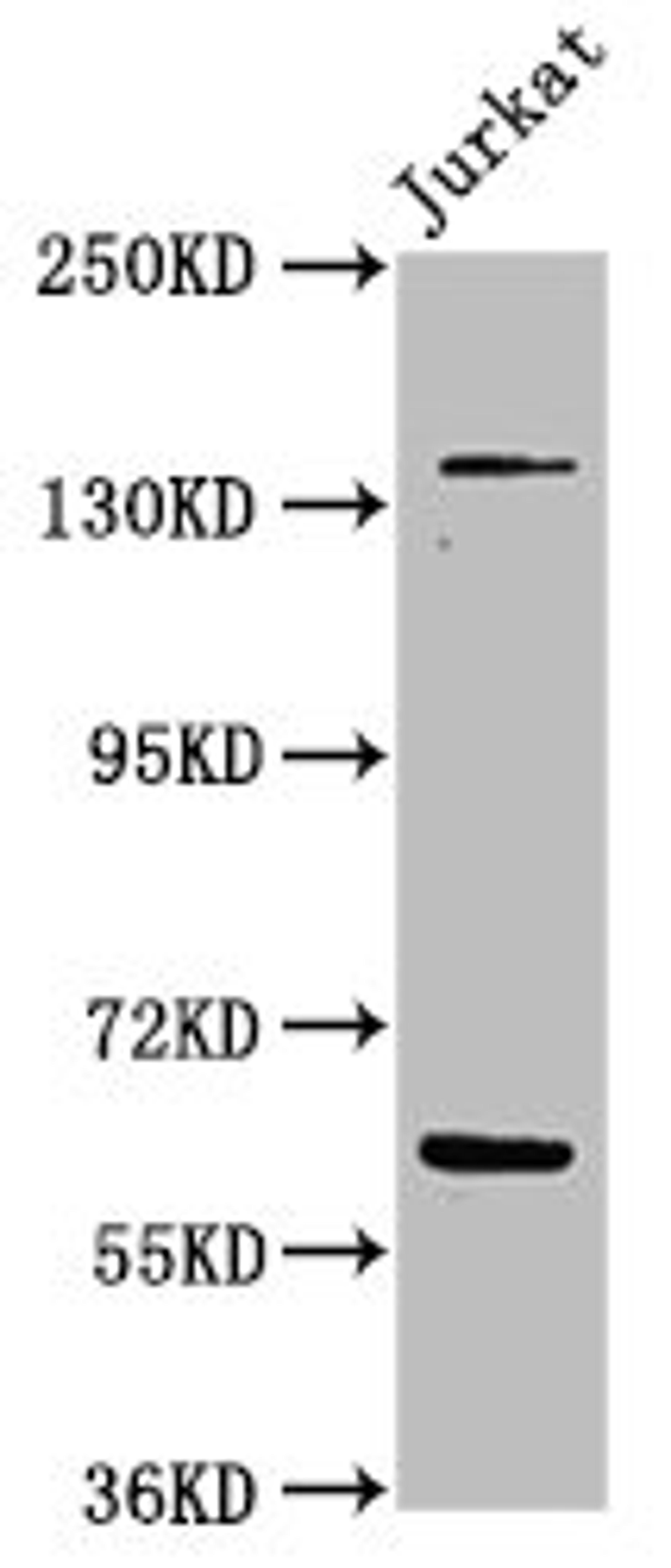 Western Blot. Positive WB detected in: Jurkat whole cell lysate. All lanes: TNKS antibody at 4.8µg/ml. Secondary. Goat polyclonal to rabbit IgG at 1/50000 dilution. Predicted band size: 143, 68 kDa. Observed band size: 143, 68 kDa