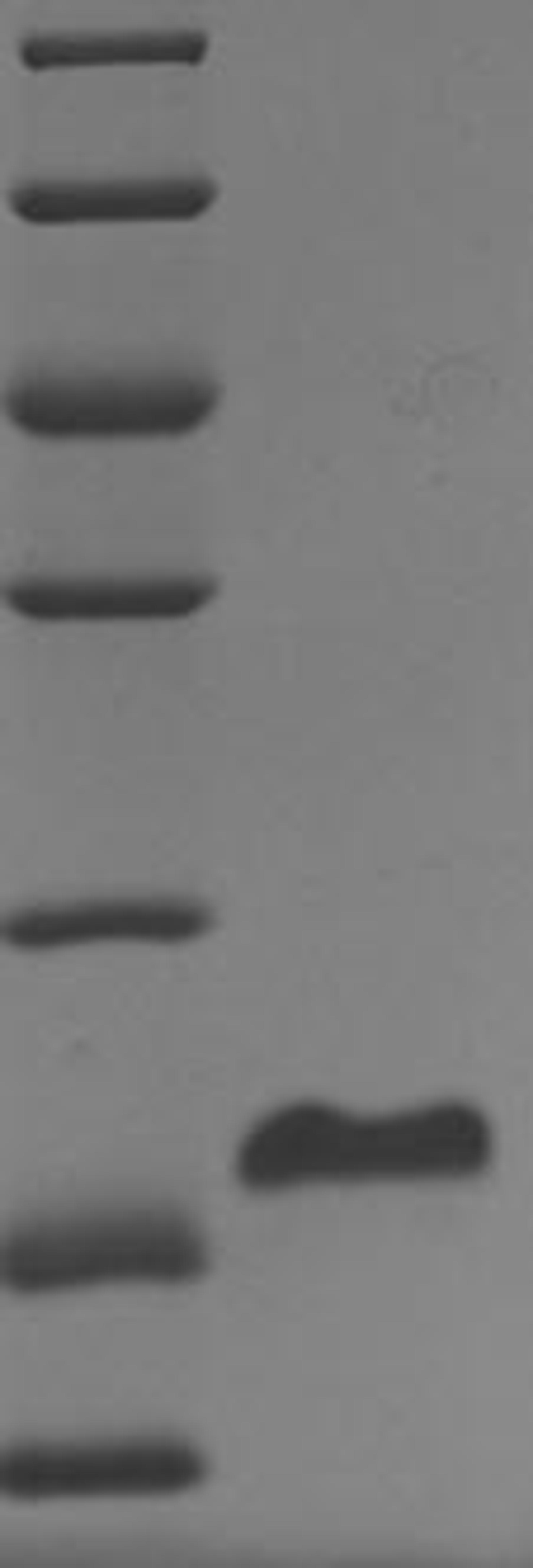 (Tris-Glycine gel) Discontinuous SDS-PAGE (reduced) with 5% enrichment gel and 15% separation gel.