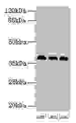 Western blot. All lanes: HNRNPD antibody at 2µg/ml. Lane 1: 293T whole cell lysate. Lane 2: Hela whole cell lysate. Lane 3: Jurkat whole cell lysate. Secondary. Goat polyclonal to rabbit IgG at 1/10000 dilution. Predicted band size: 39, 37, 33, 31 kDa. Observed band size: 39 kDa