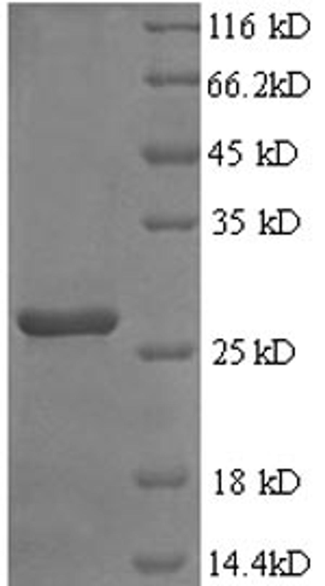 (Tris-Glycine gel) Discontinuous SDS-PAGE (reduced) with 5% enrichment gel and 15% separation gel.