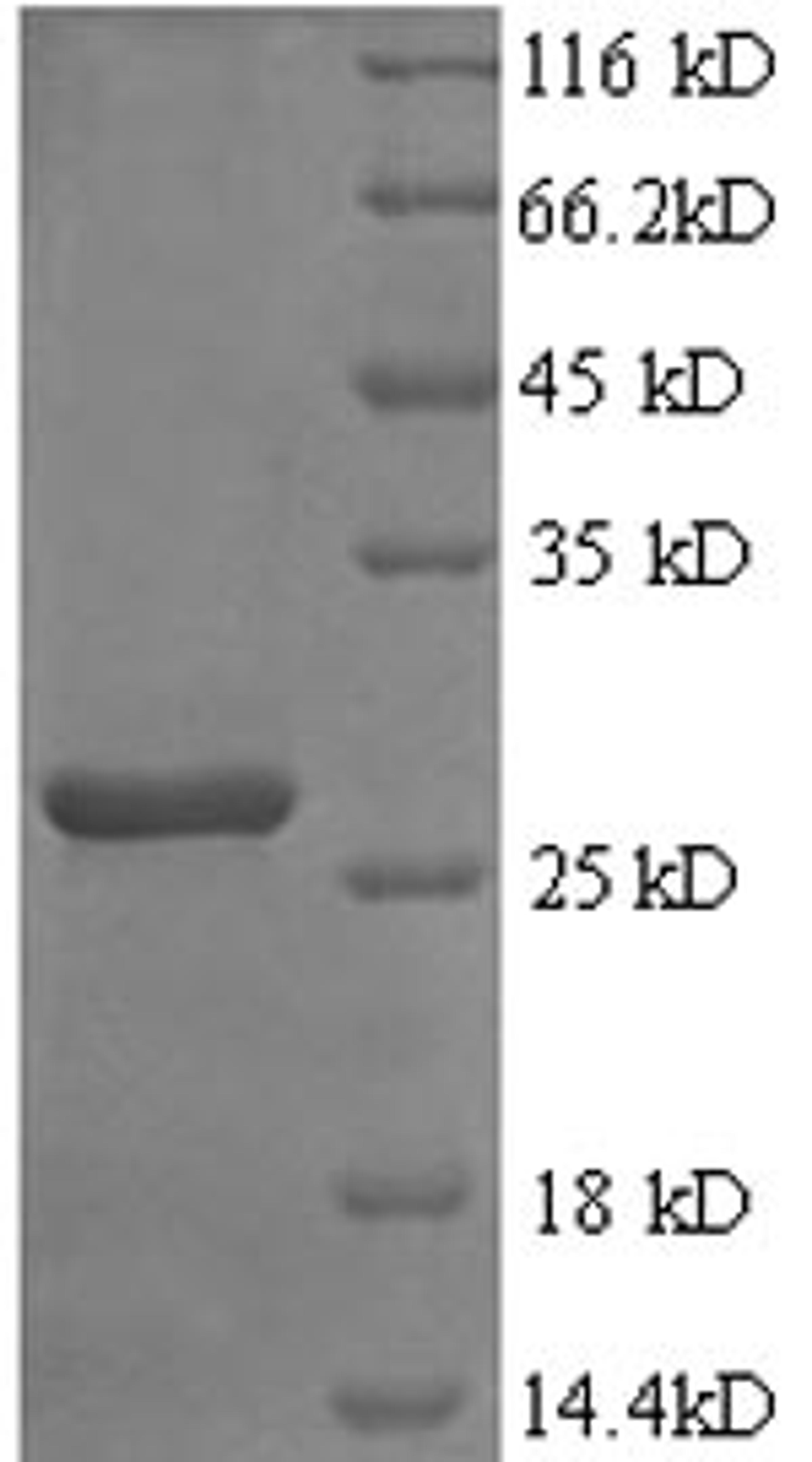 (Tris-Glycine gel) Discontinuous SDS-PAGE (reduced) with 5% enrichment gel and 15% separation gel.