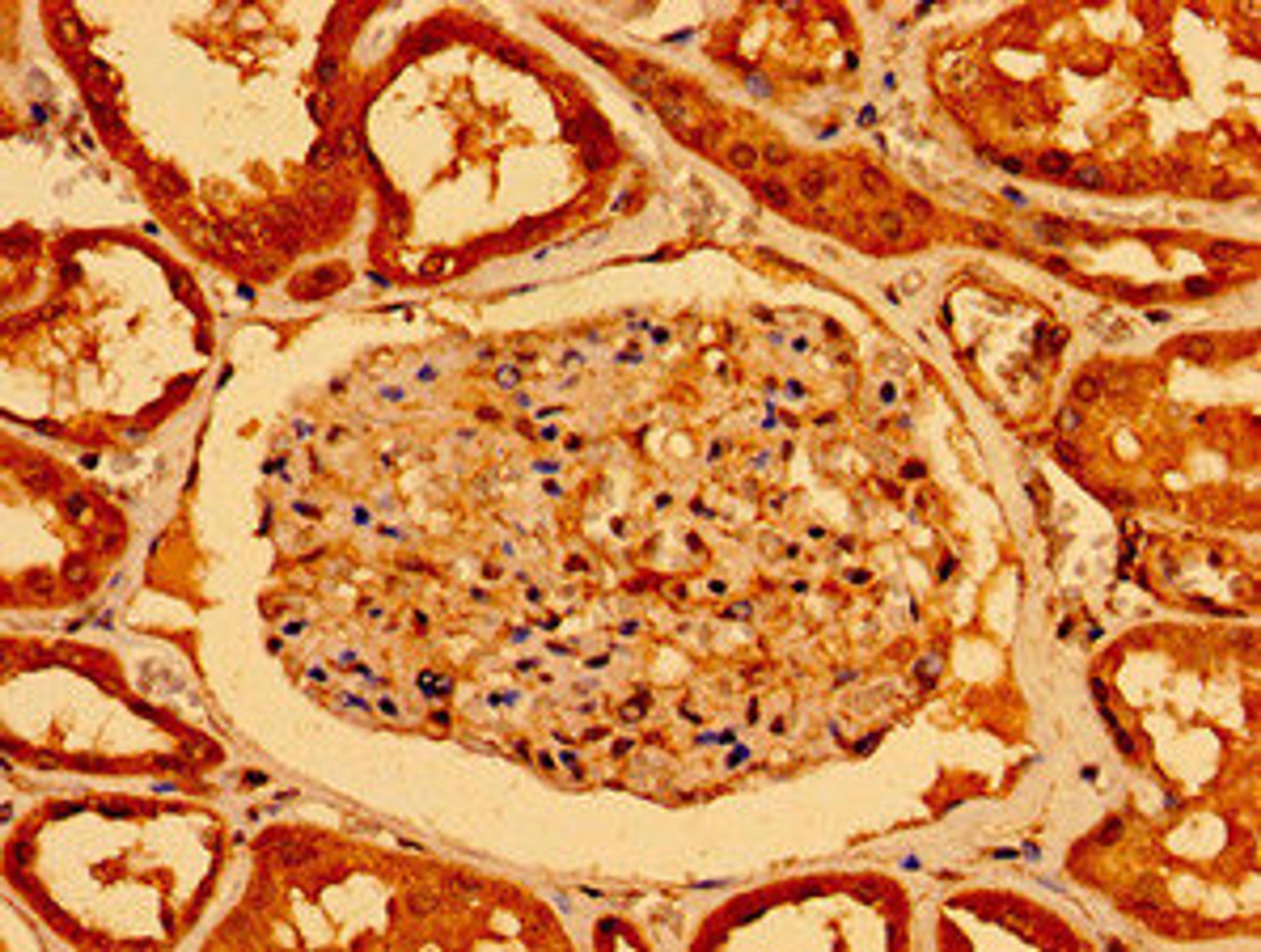 Immunohistochemistry of paraffin-embedded human kidney tissue using CSB-PA015950LA01HU at dilution of 1:100
