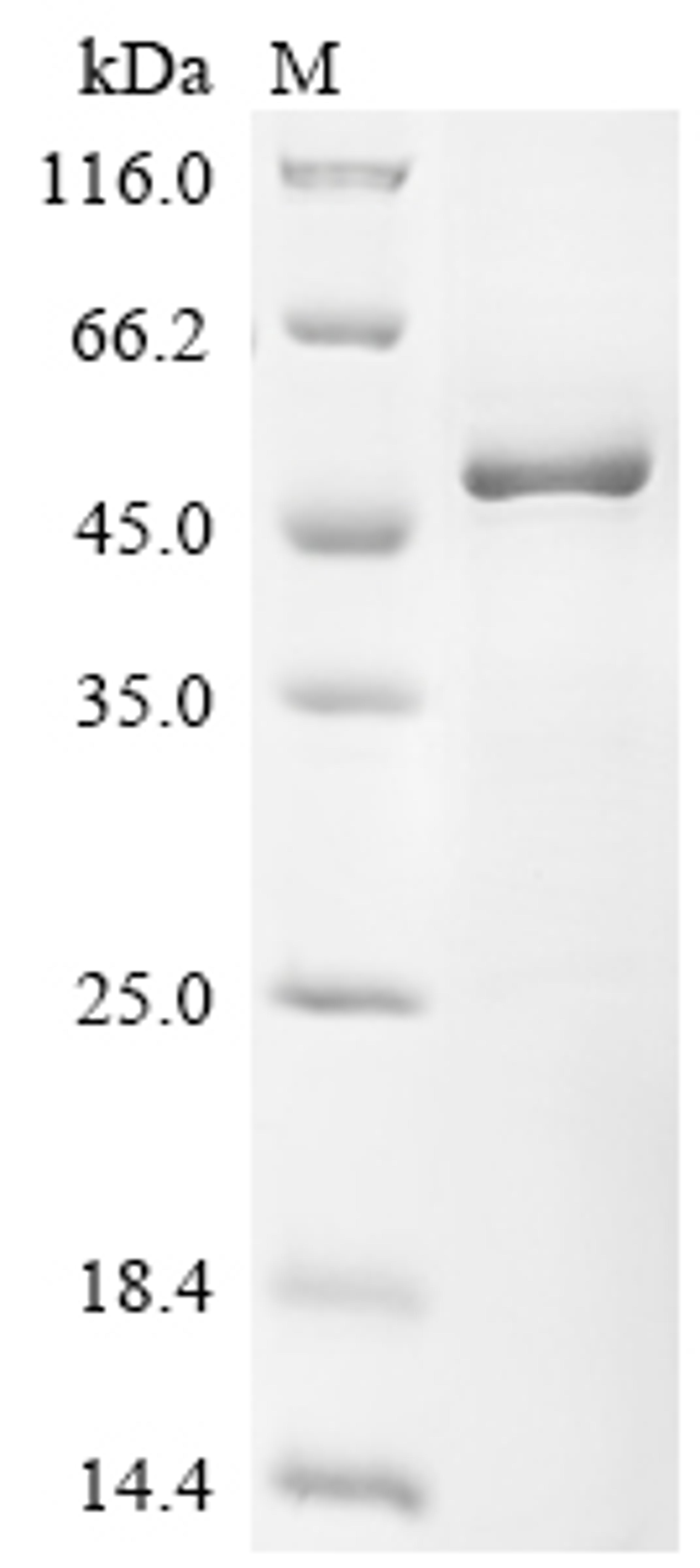 (Tris-Glycine gel) Discontinuous SDS-PAGE (reduced) with 5% enrichment gel and 15% separation gel.