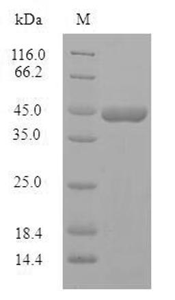 (Tris-Glycine gel) Discontinuous SDS-PAGE (reduced) with 5% enrichment gel and 15% separation gel.