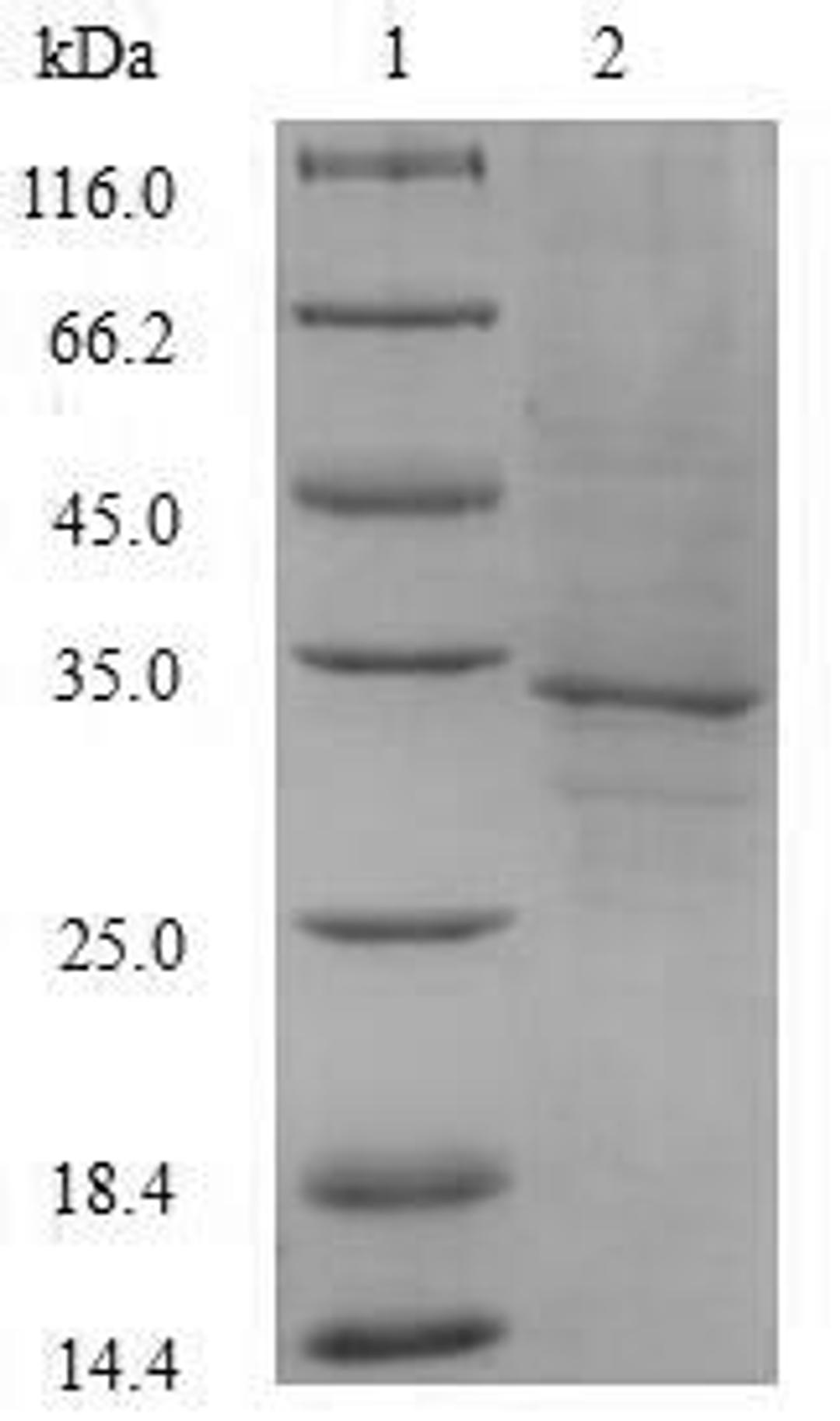 (Tris-Glycine gel) Discontinuous SDS-PAGE (reduced) with 5% enrichment gel and 15% separation gel.