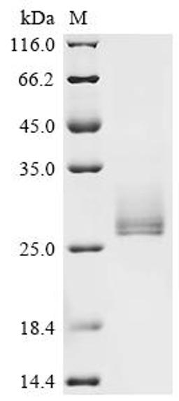 (Tris-Glycine gel) Discontinuous SDS-PAGE (reduced) with 5% enrichment gel and 15% separation gel.