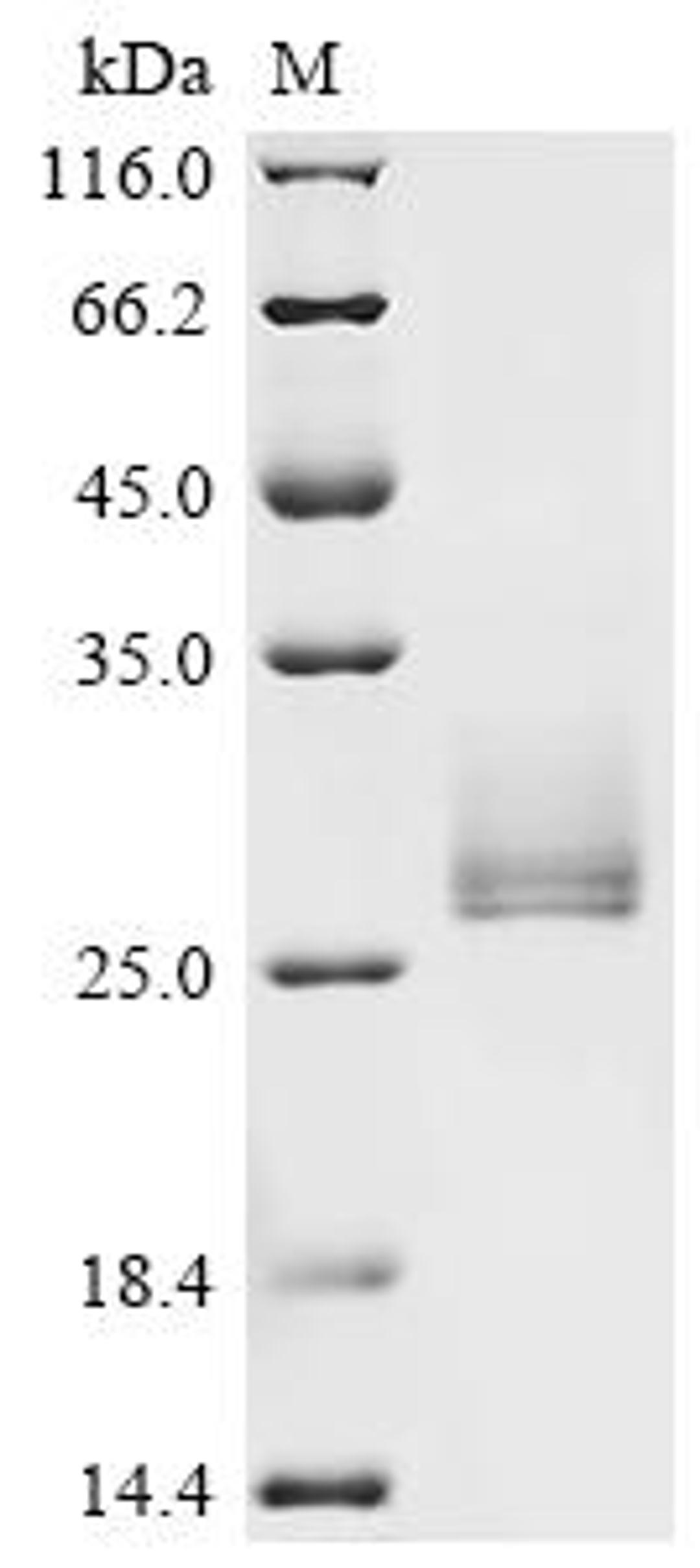 (Tris-Glycine gel) Discontinuous SDS-PAGE (reduced) with 5% enrichment gel and 15% separation gel.