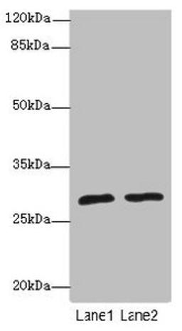 Western blot. All lanes: APIPantibody at 1.85ug/ml. Lane 1: Mouse heart tissue. Lane 2: Mouse kidney tissue. Secondary. Goat polyclonal to rabbit IgG at 1/10000 dilution. Predicted band size: 28, 23 kDa. Observed band size: 28 kDa. 