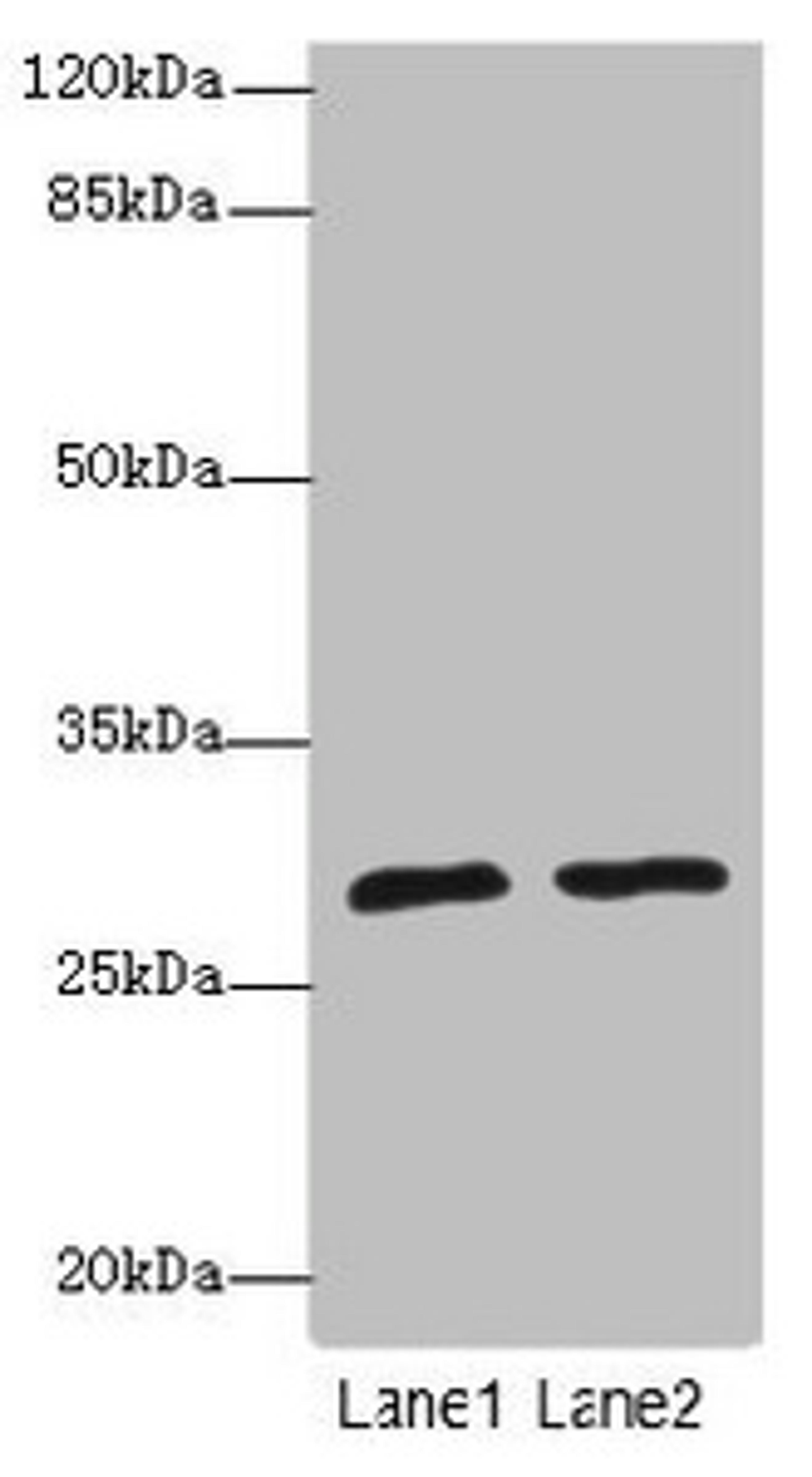 Western blot. All lanes: APIPantibody at 1.85ug/ml. Lane 1: Mouse heart tissue. Lane 2: Mouse kidney tissue. Secondary. Goat polyclonal to rabbit IgG at 1/10000 dilution. Predicted band size: 28, 23 kDa. Observed band size: 28 kDa. 