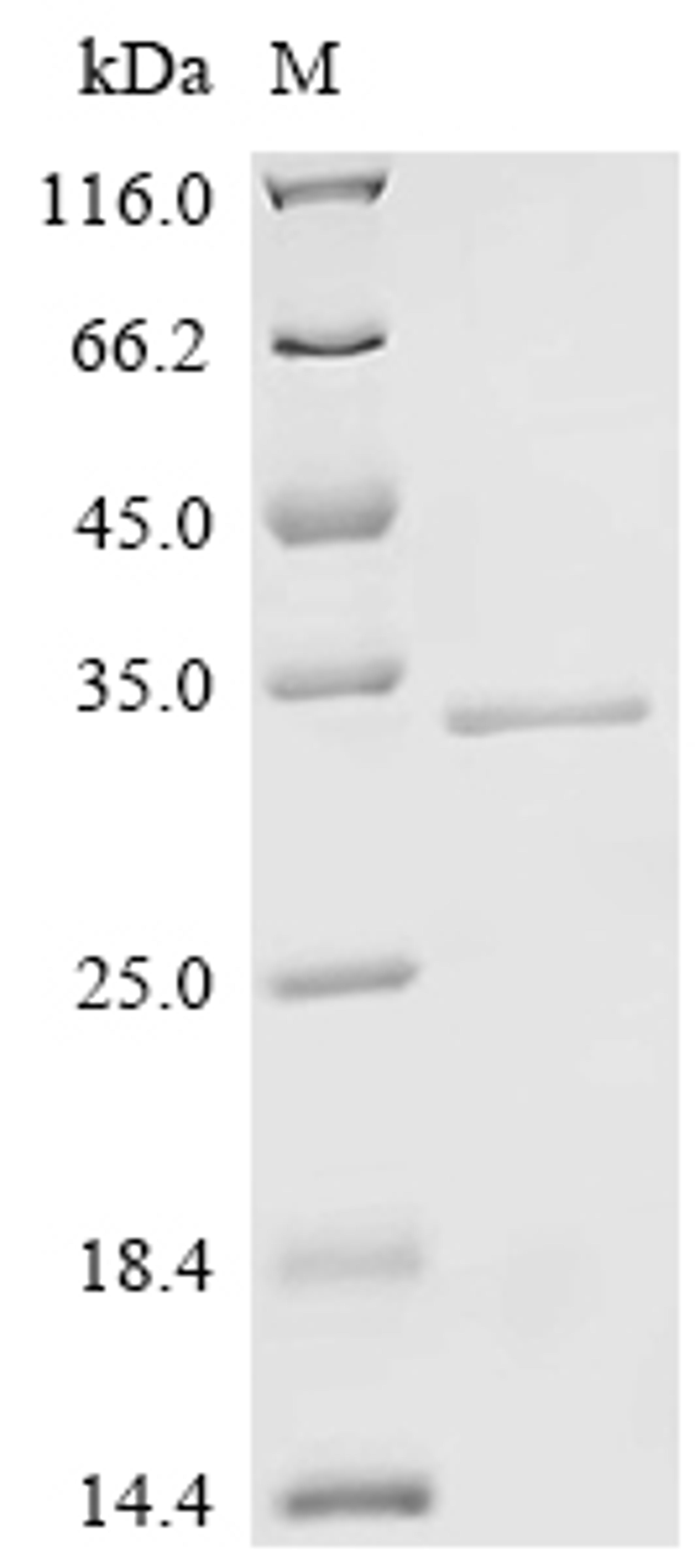 (Tris-Glycine gel) Discontinuous SDS-PAGE (reduced) with 5% enrichment gel and 15% separation gel.