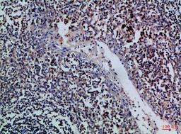 Immunohistochemical analysis of paraffin-embedded Human-tonsil, antibody was diluted at 1:100