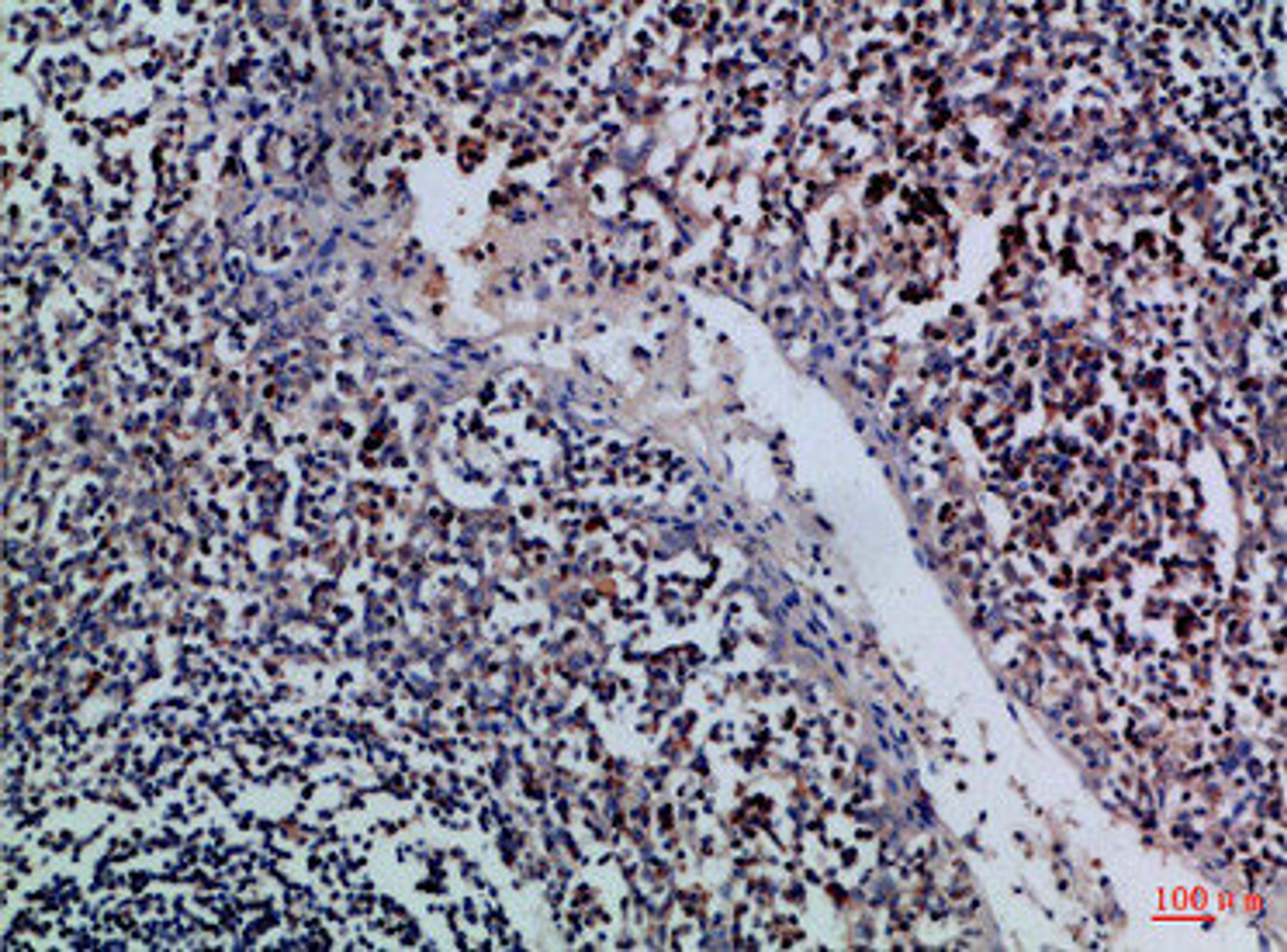 Immunohistochemical analysis of paraffin-embedded Human-tonsil, antibody was diluted at 1:100